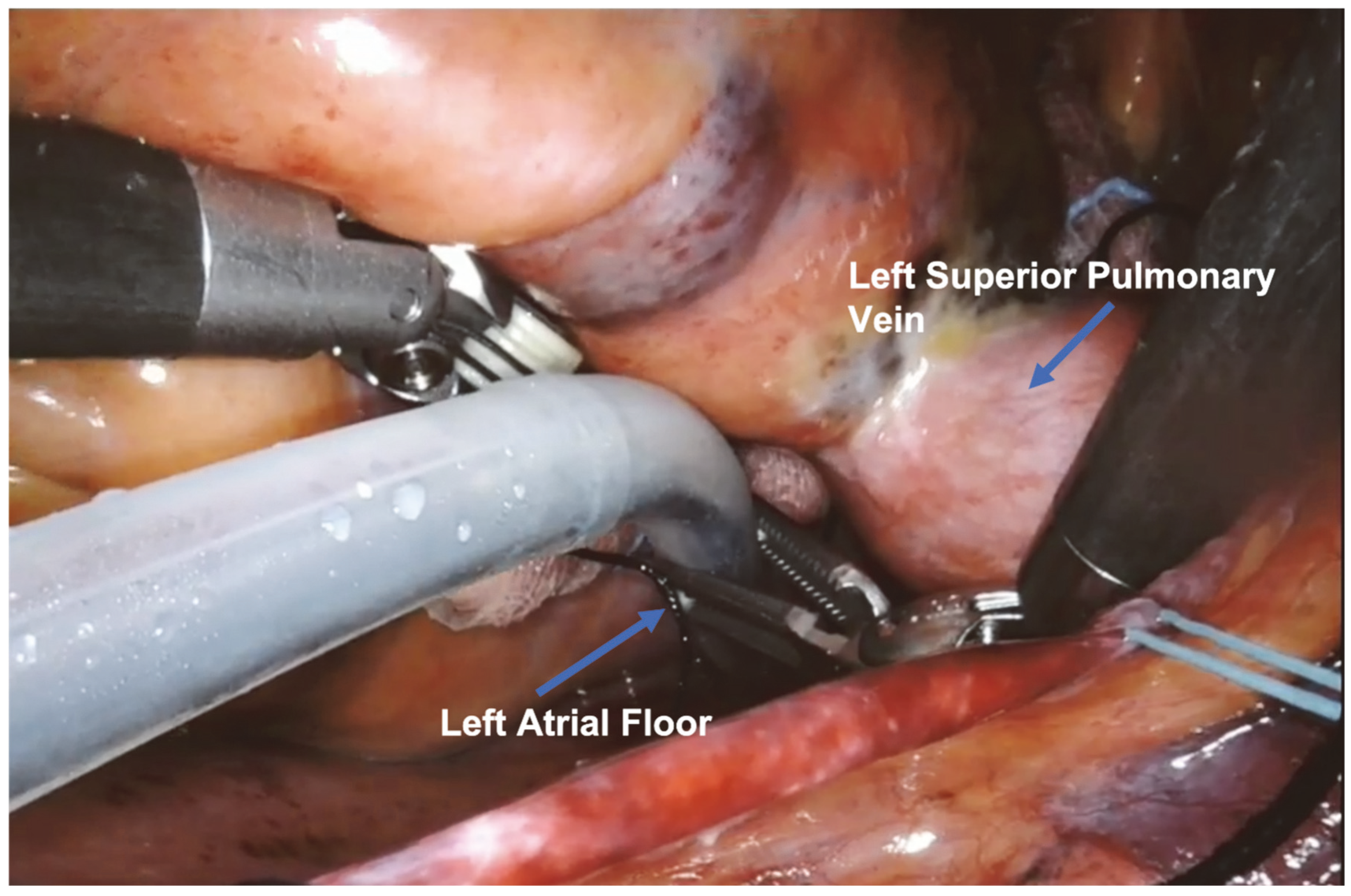 Jcm 13 01563 g005 Jcm 13 01563 g005