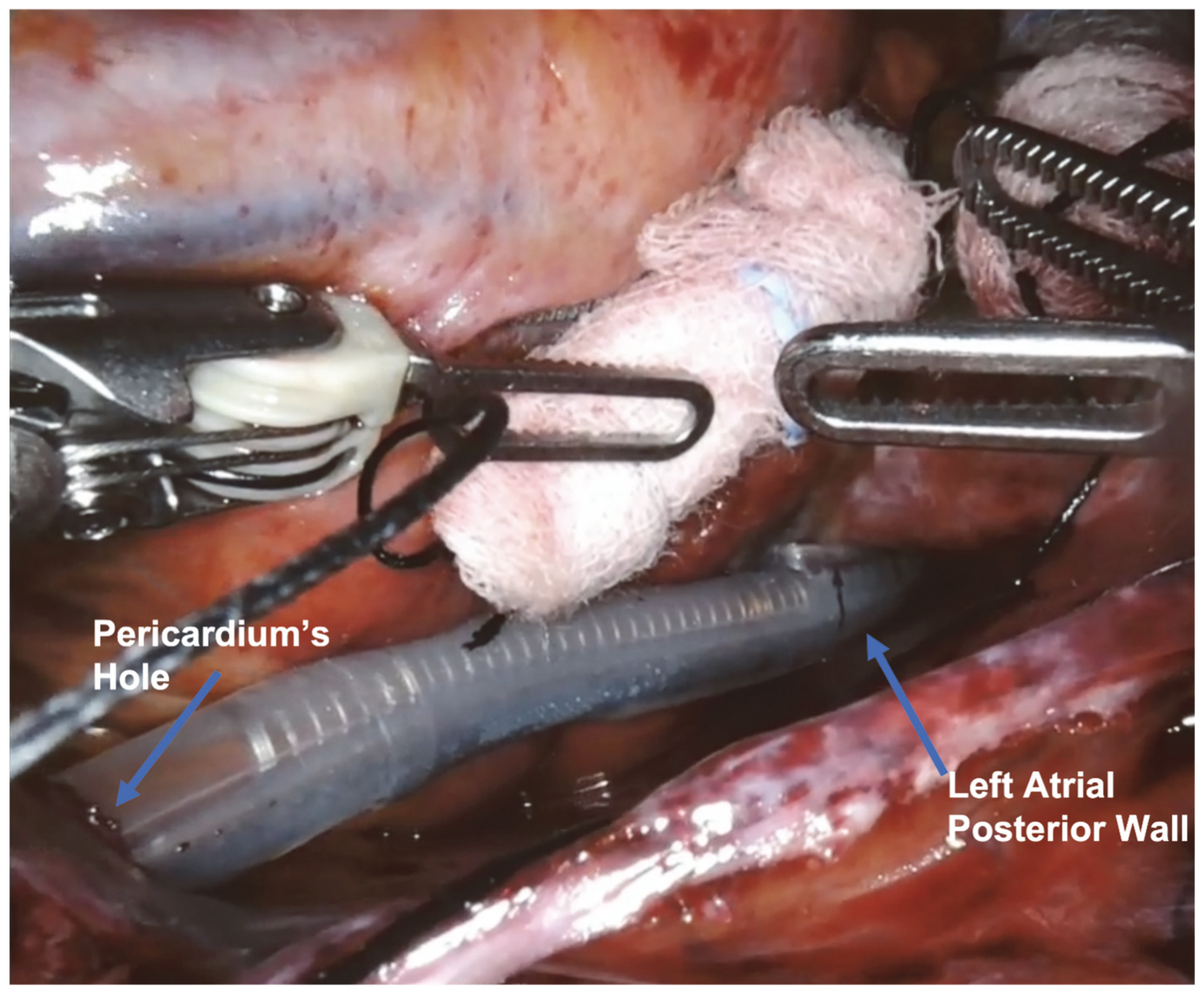 Jcm 13 01563 g006 Jcm 13 01563 g006