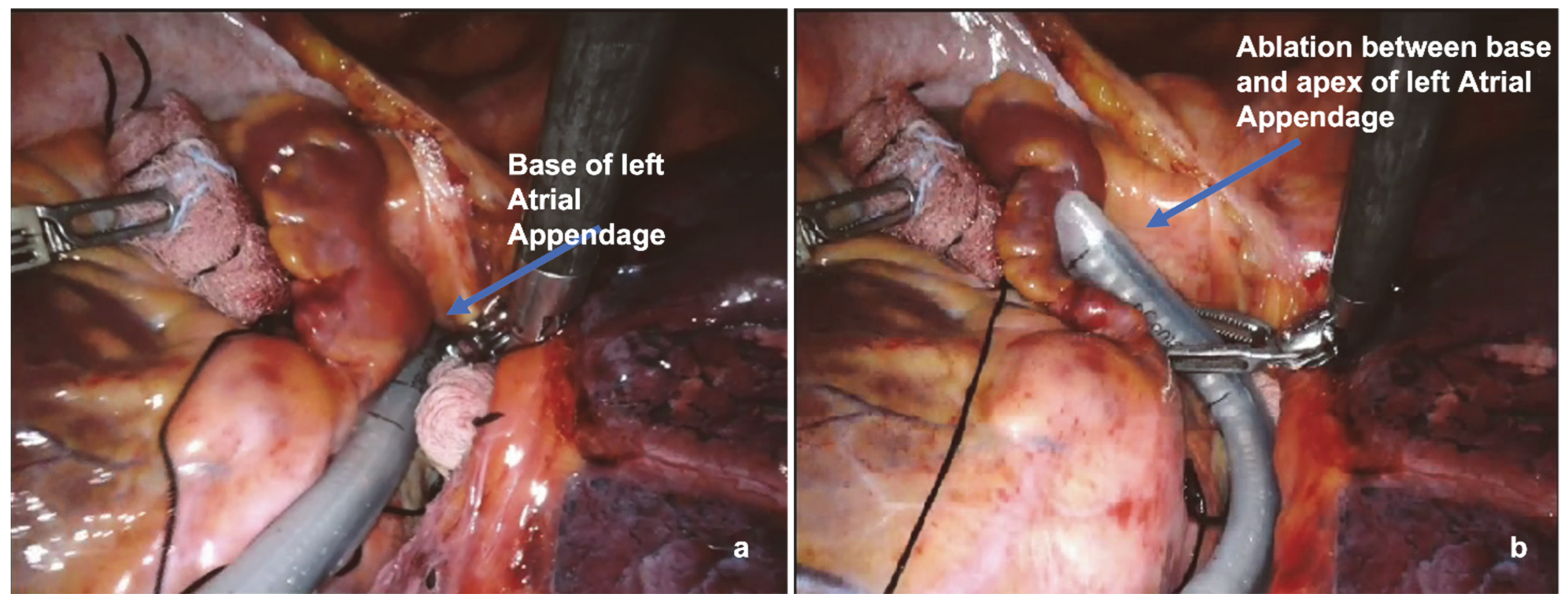 Jcm 13 01563 g007 Jcm 13 01563 g007
