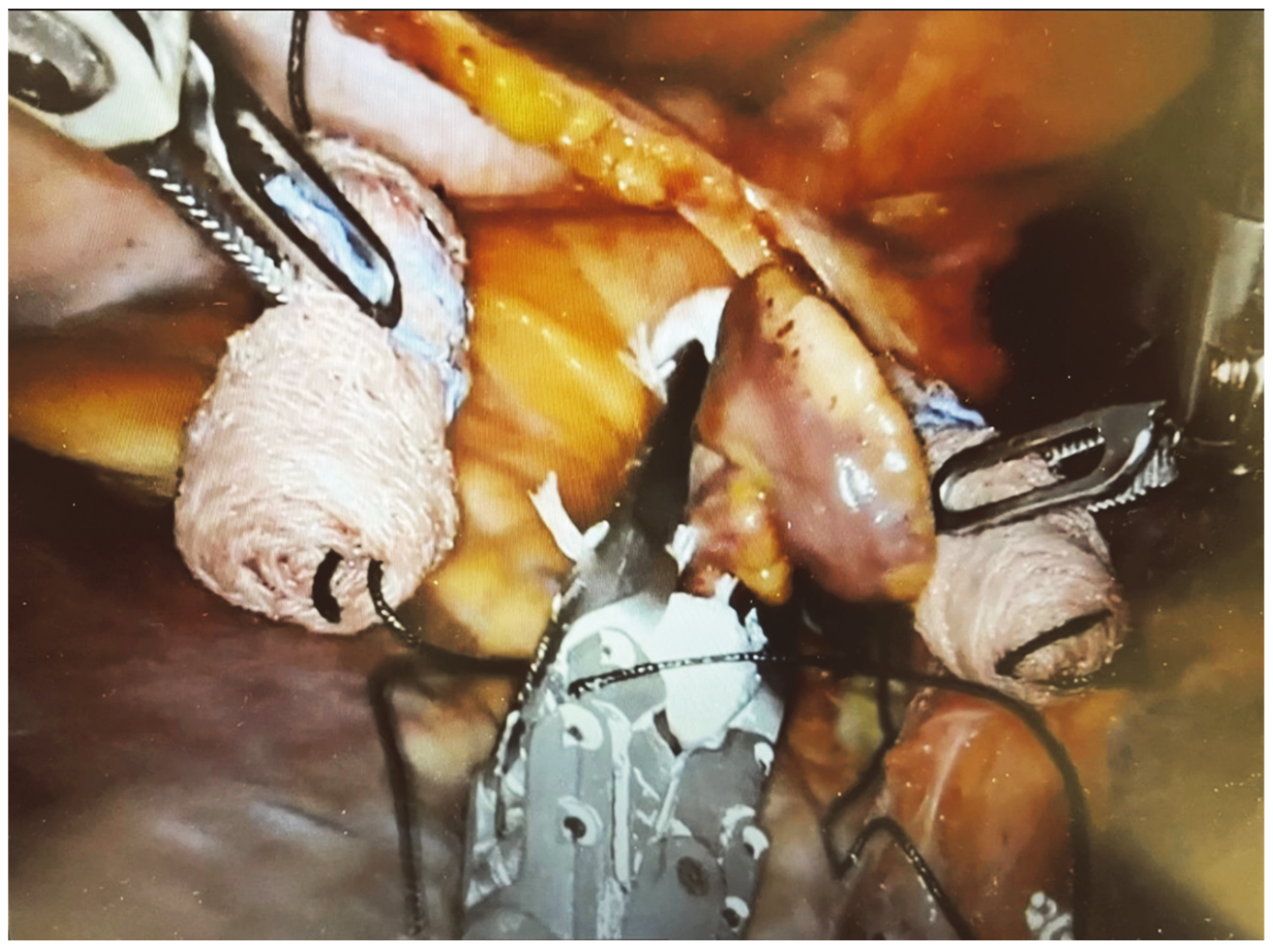 Jcm 13 01563 g009 Jcm 13 01563 g009