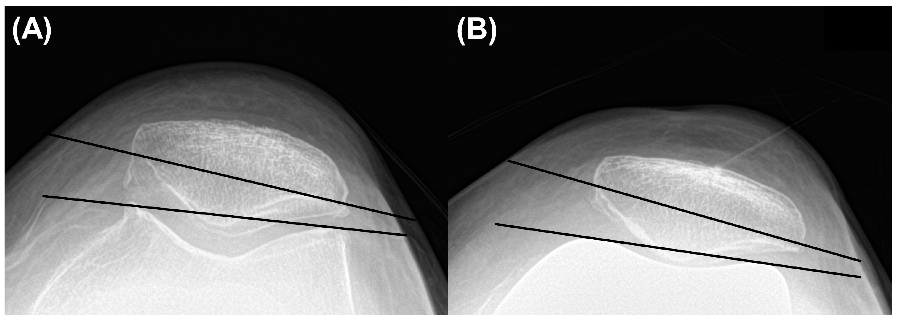 Jcm 13 01595 g003 Jcm 13 01595 g003
