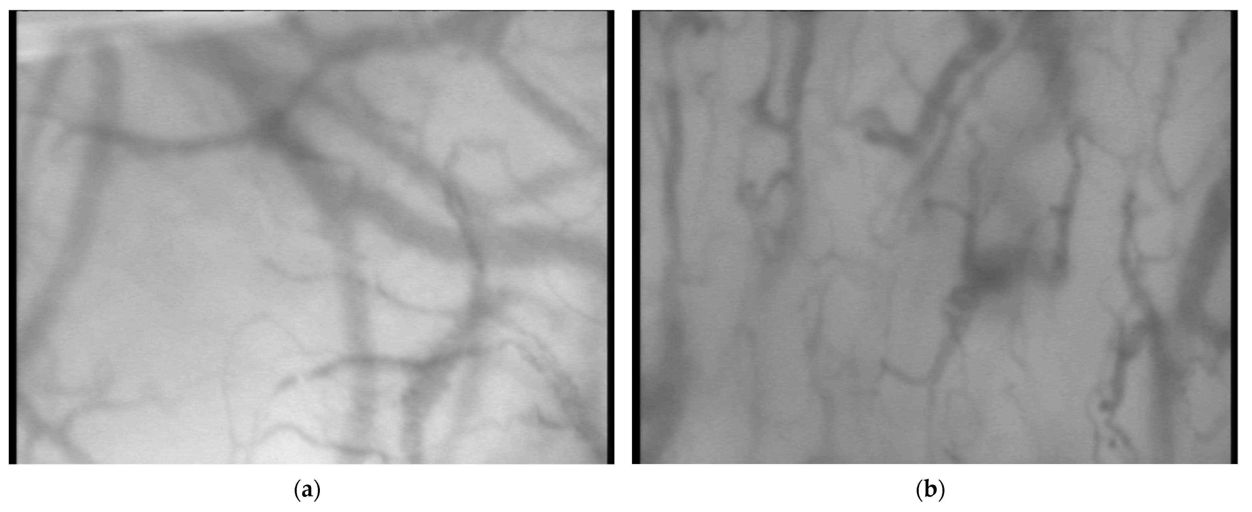 Jcm 13 01655 g001 Jcm 13 01655 g001