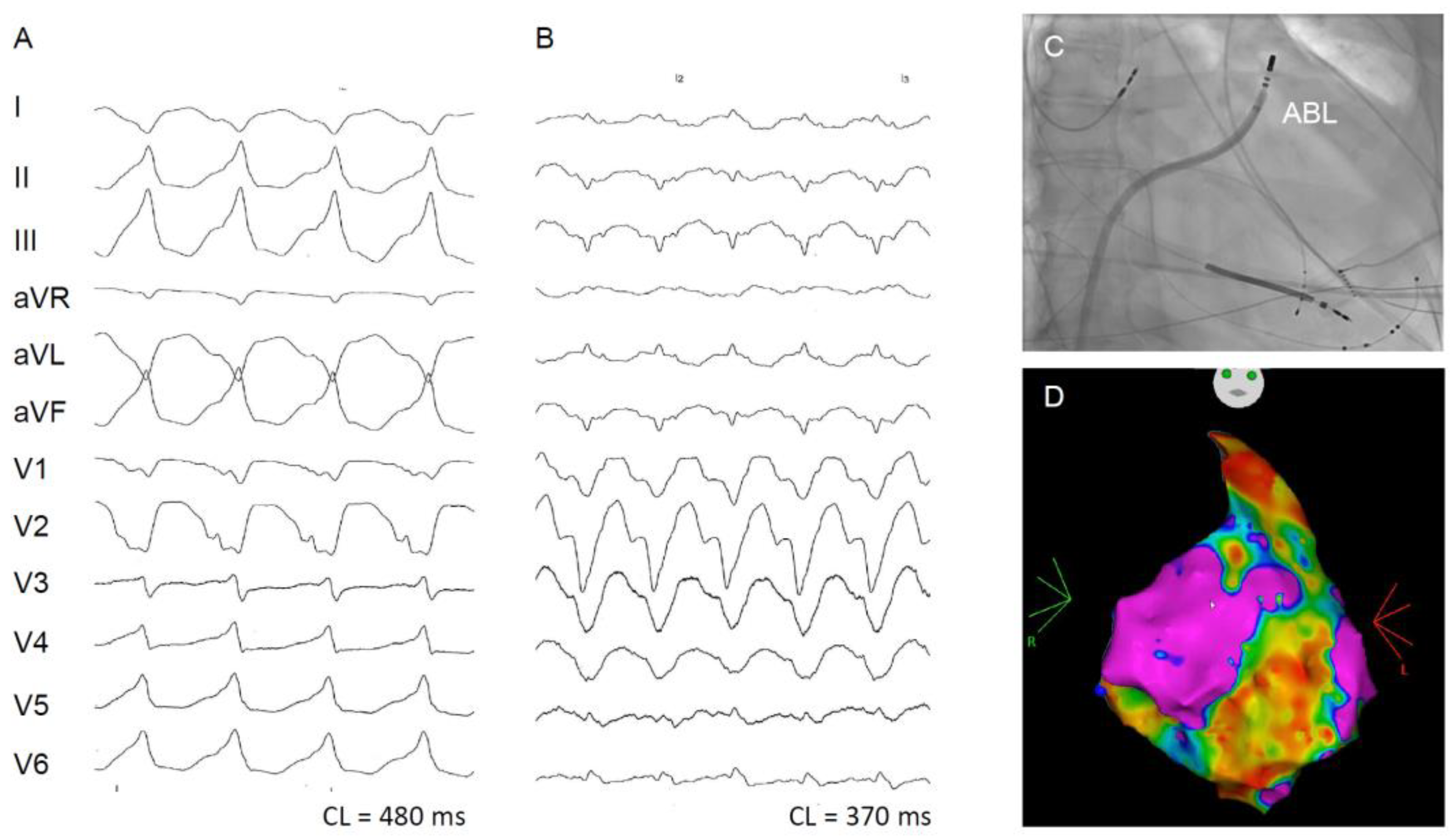 Jcm 13 01694 g001 Jcm 13 01694 g001