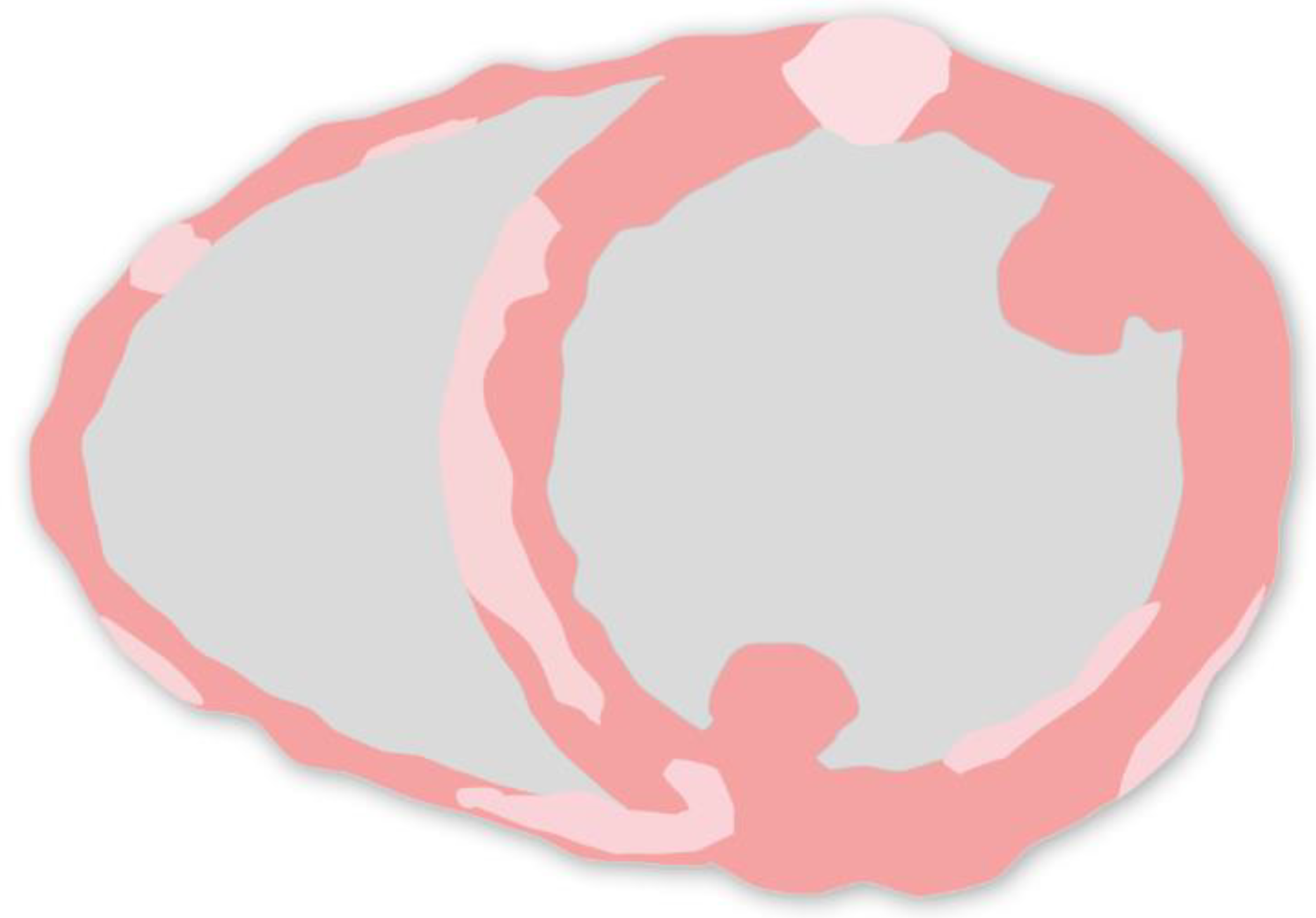 Jcm 13 01694 g003 Jcm 13 01694 g003