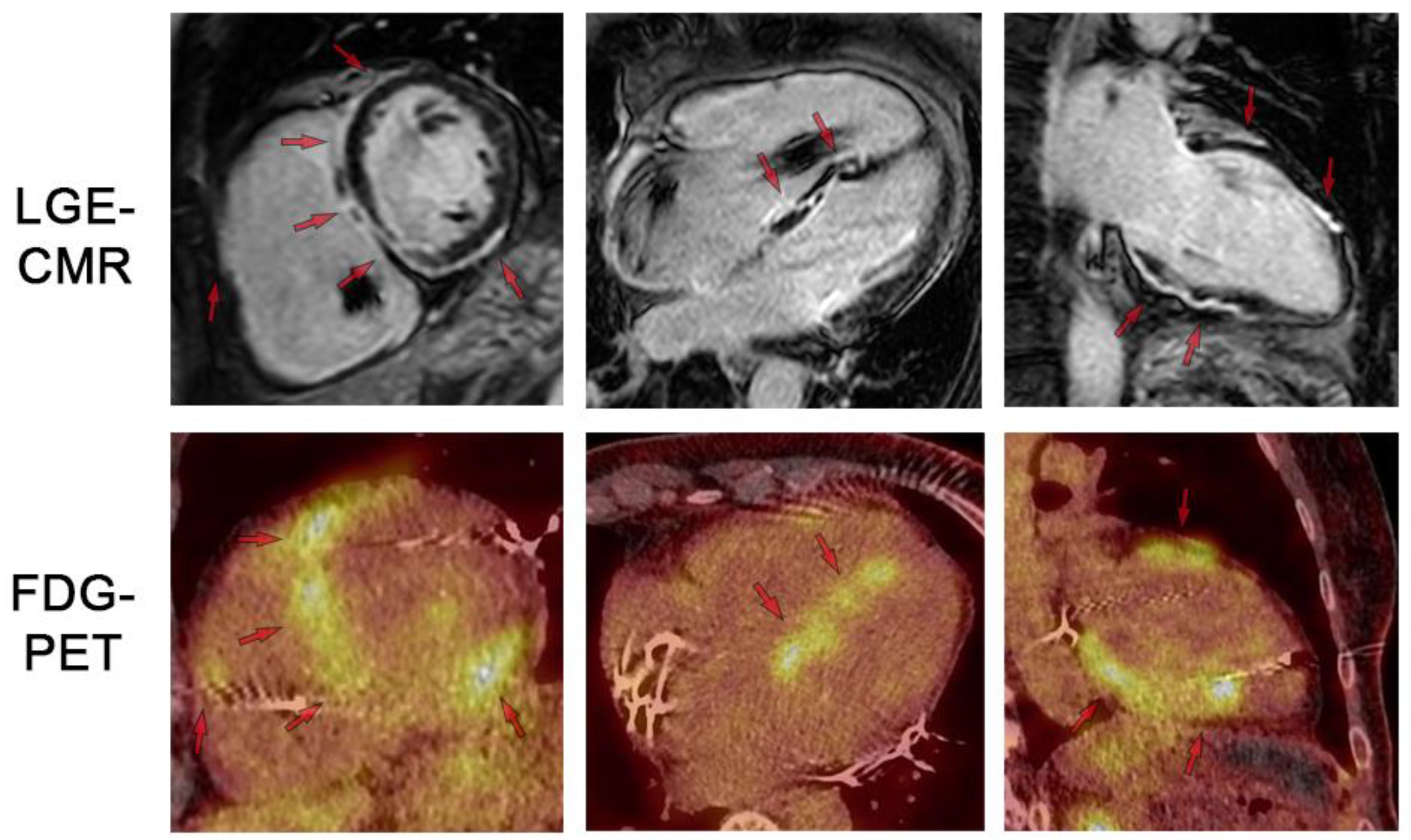 Jcm 13 01694 g004 Jcm 13 01694 g004