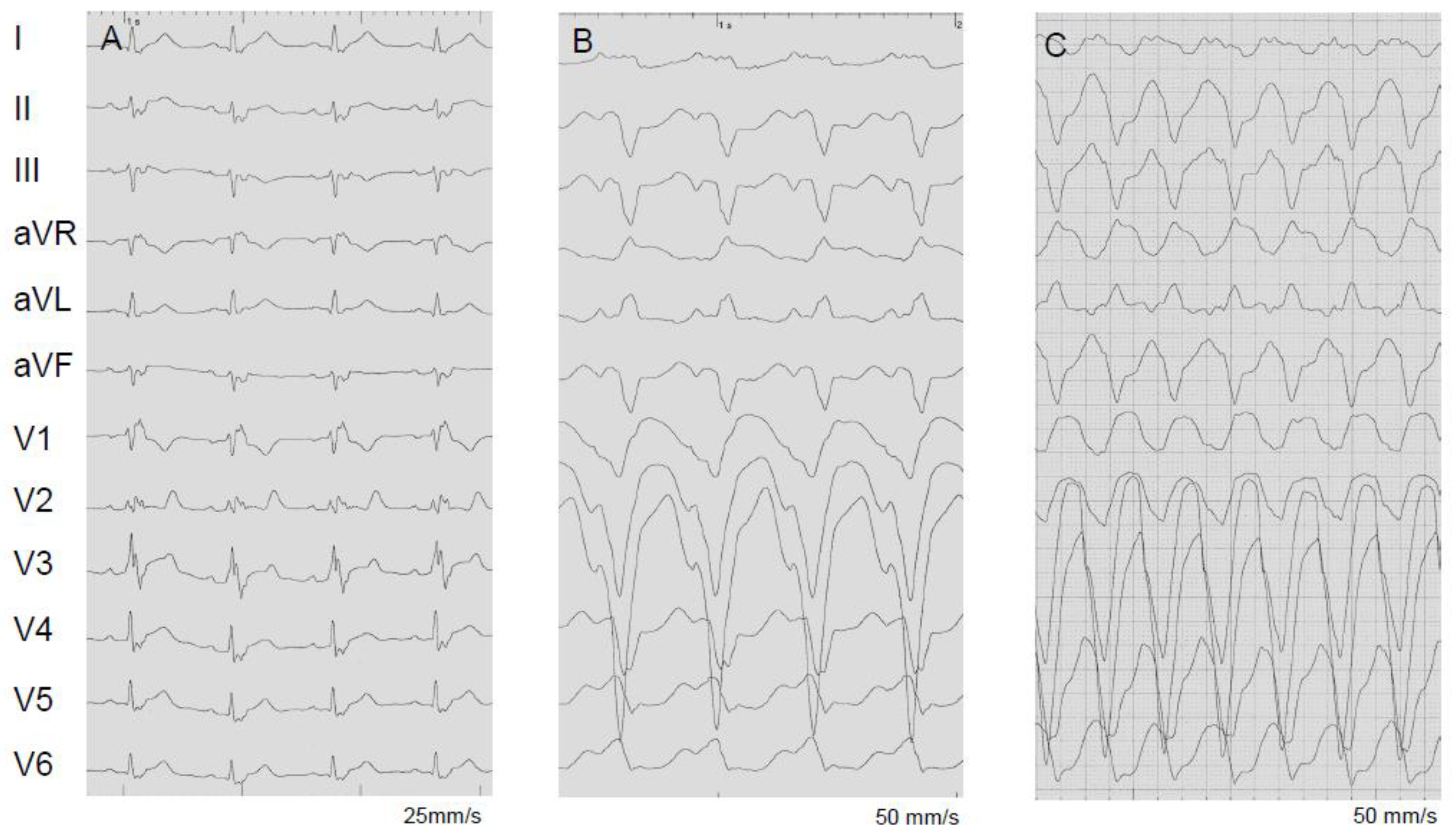 Jcm 13 01694 g006 Jcm 13 01694 g006