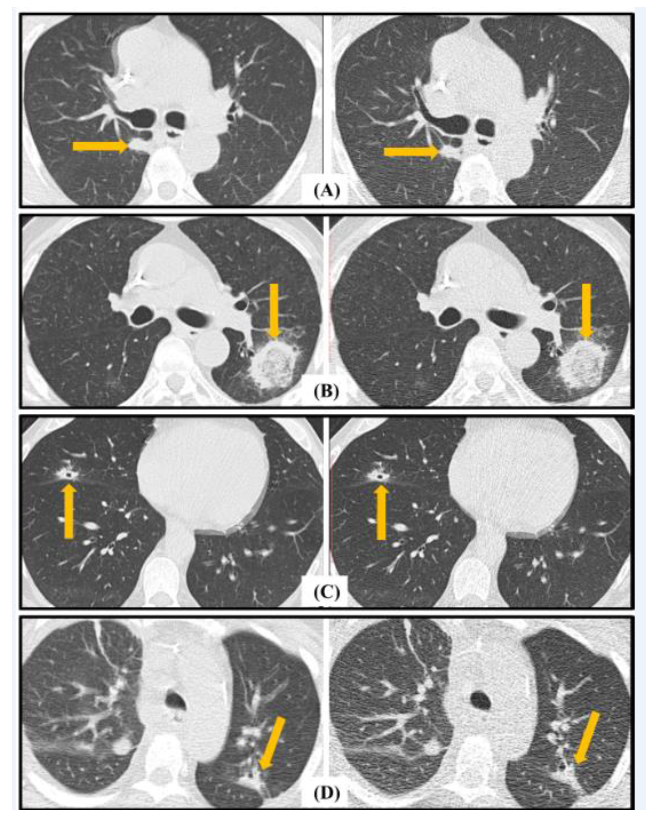 Jcm 13 01704 g004 Jcm 13 01704 g004