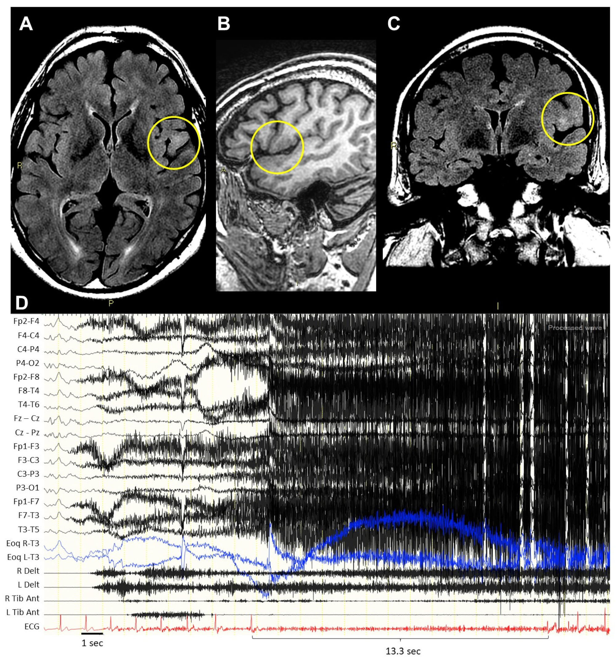 Jcm 13 01767 g001 Jcm 13 01767 g001