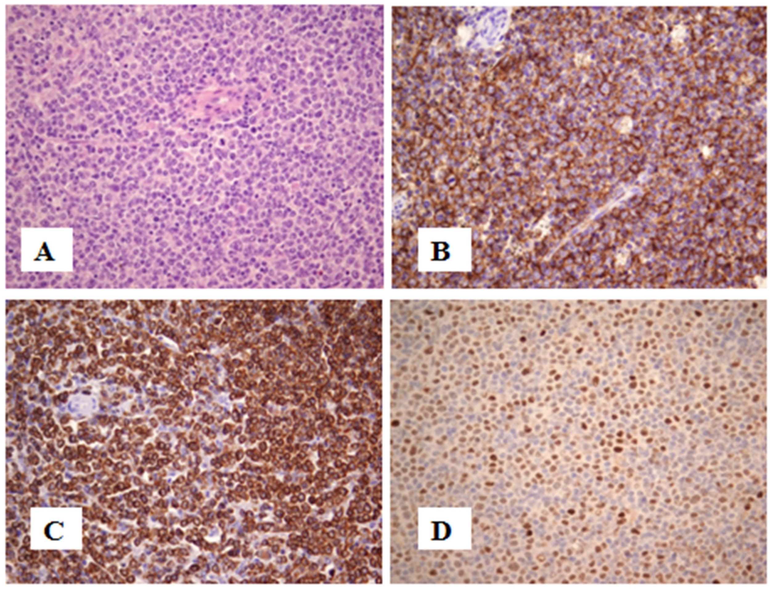 Jcm 13 01816 g001a Jcm 13 01816 g001a