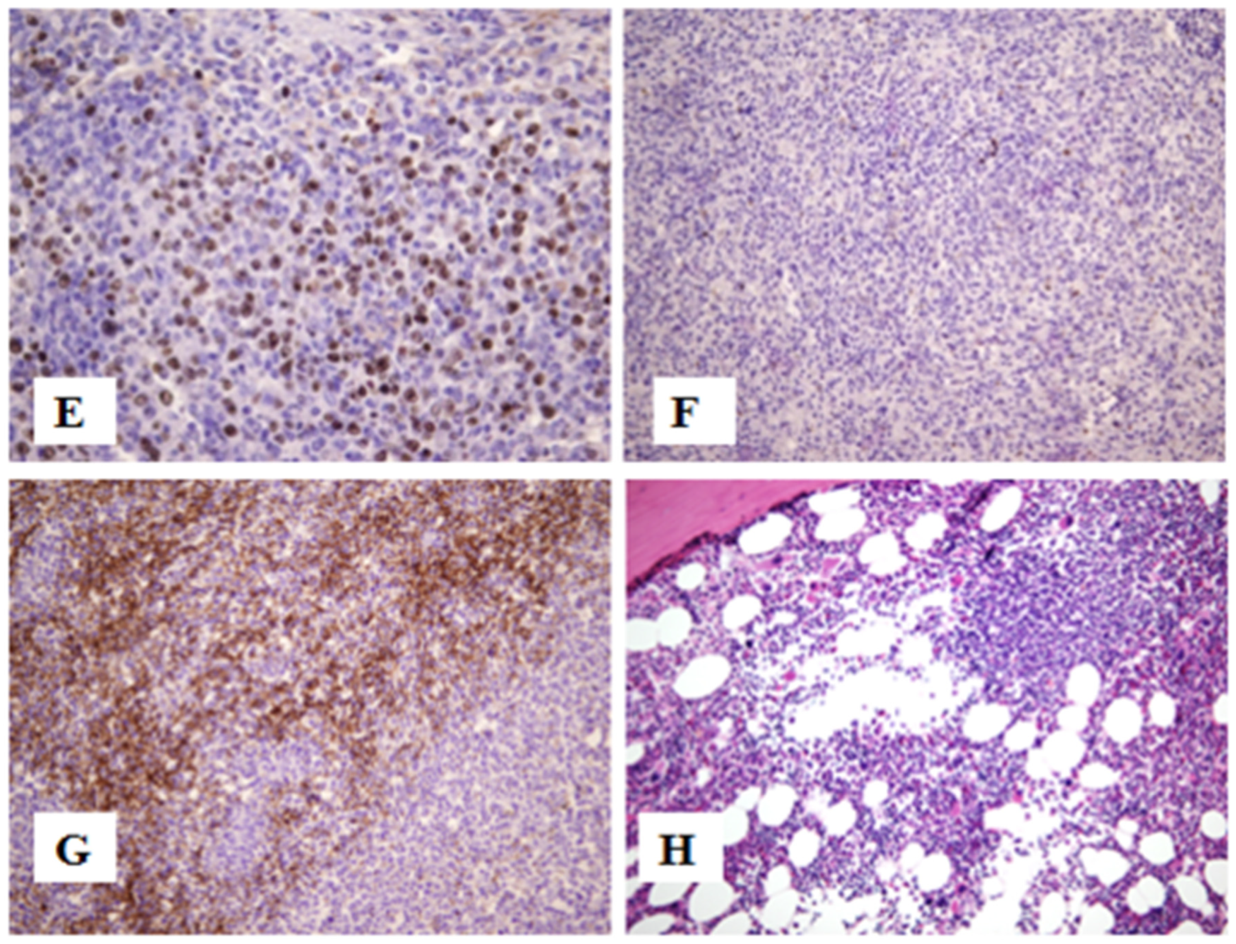 Jcm 13 01816 g001b Jcm 13 01816 g001b