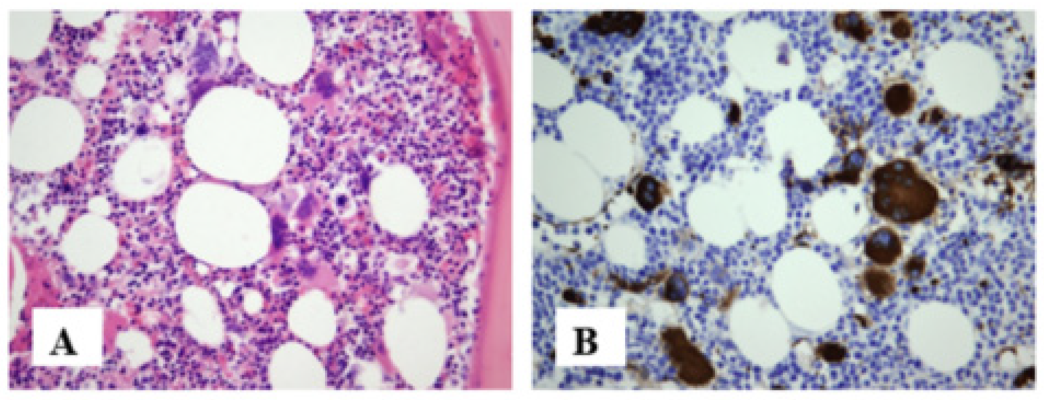 Jcm 13 01816 g003a Jcm 13 01816 g003a