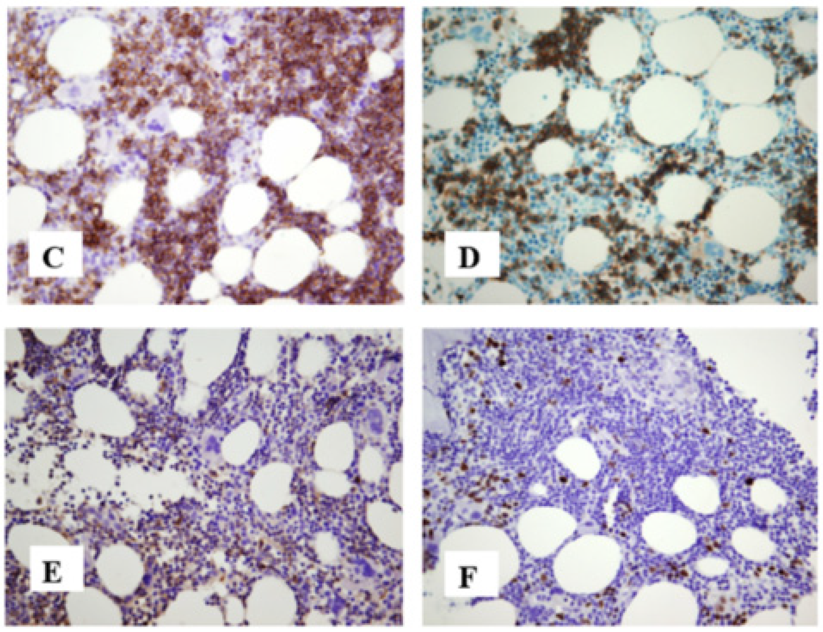 Jcm 13 01816 g003b Jcm 13 01816 g003b