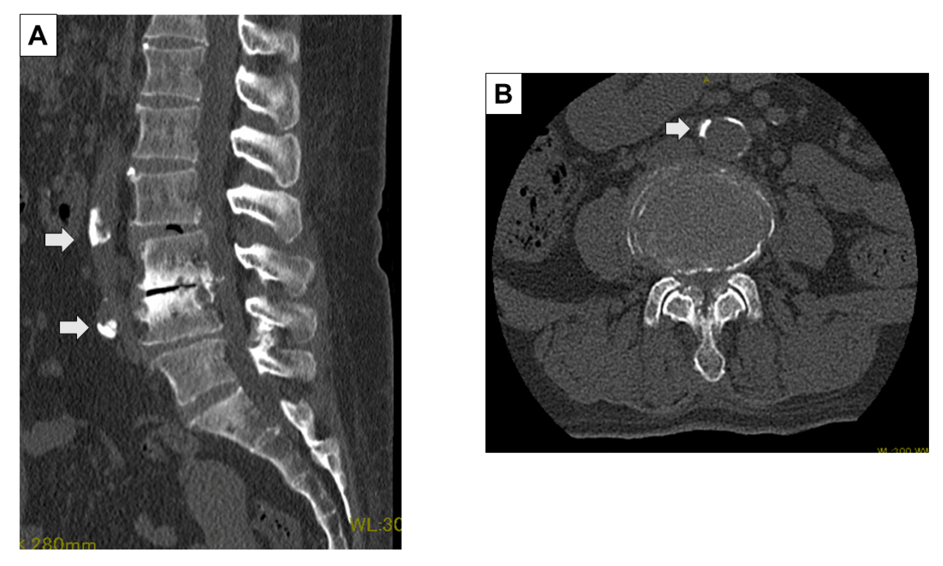 Jcm 13 01897 g002 Jcm 13 01897 g002