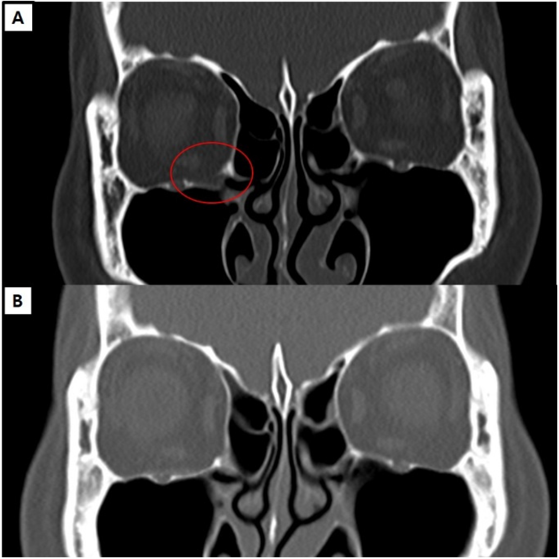 Jcm 13 01900 g003 Jcm 13 01900 g003