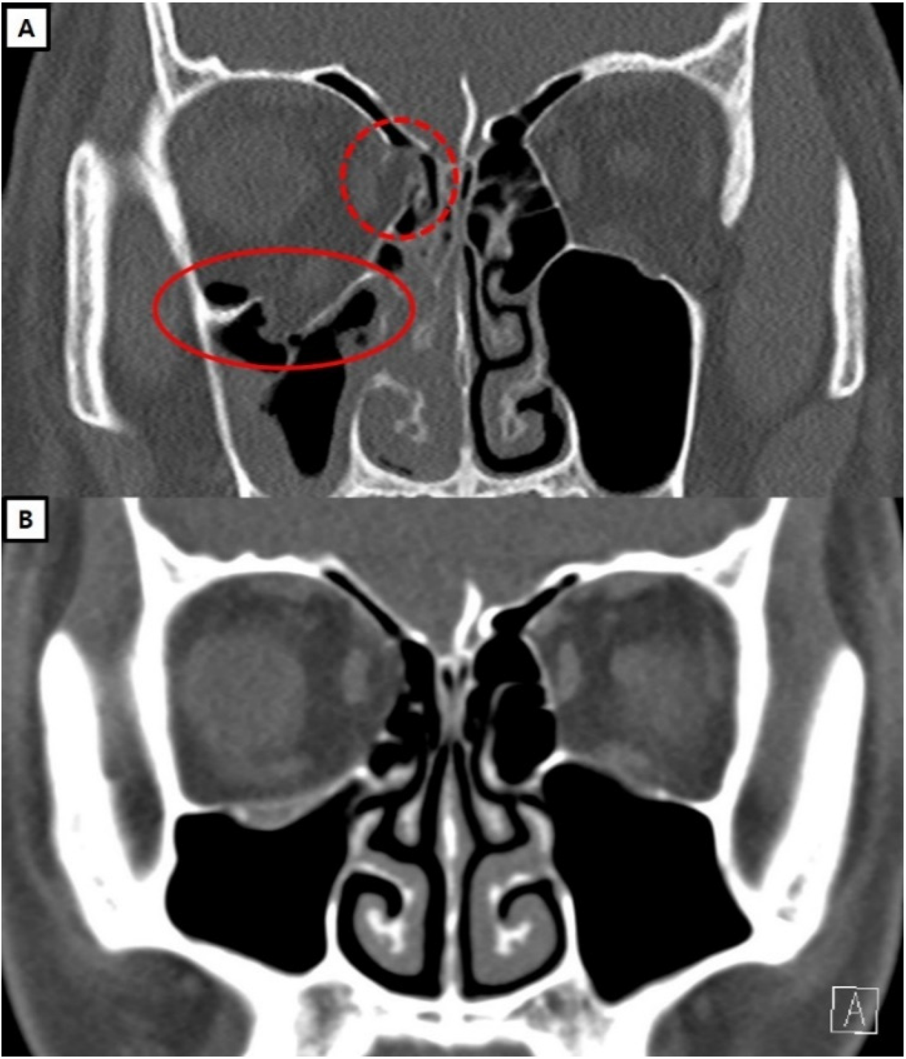Jcm 13 01900 g004 Jcm 13 01900 g004