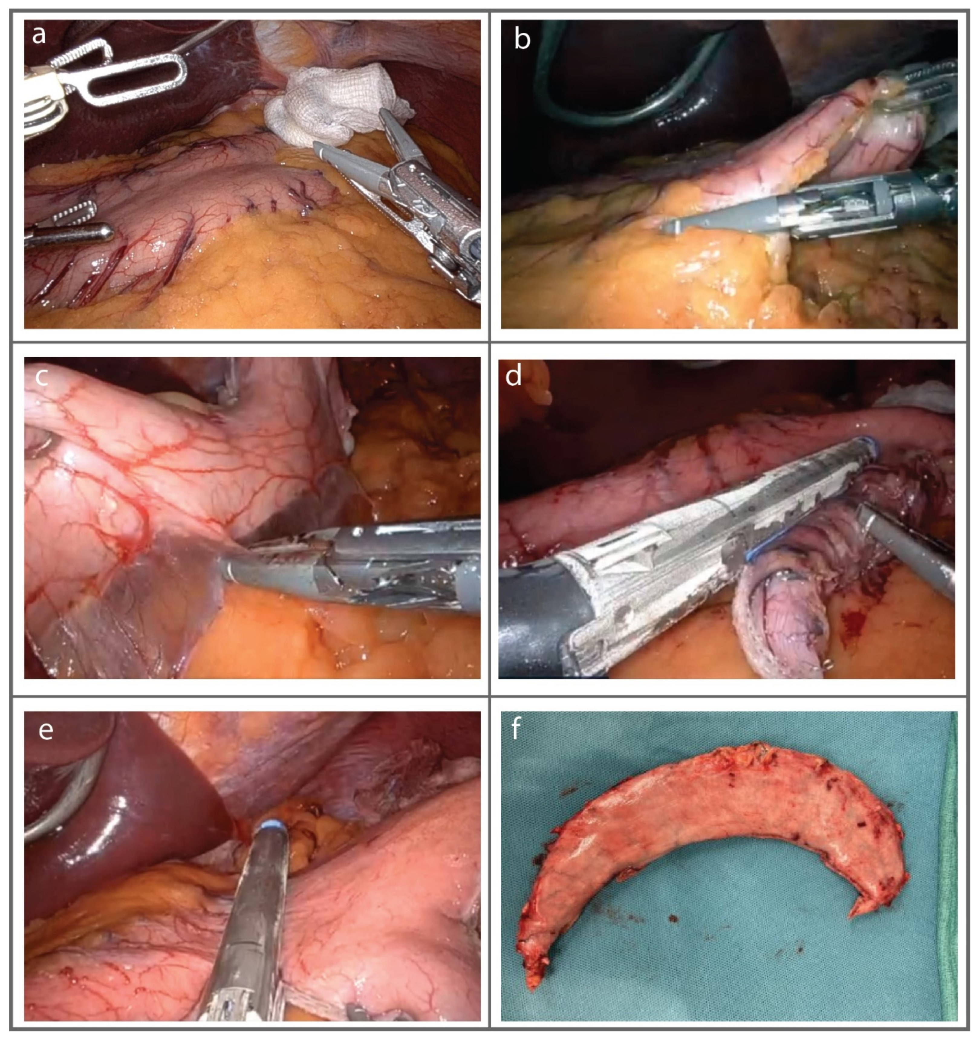 Jcm 13 01954 g002 Jcm 13 01954 g002