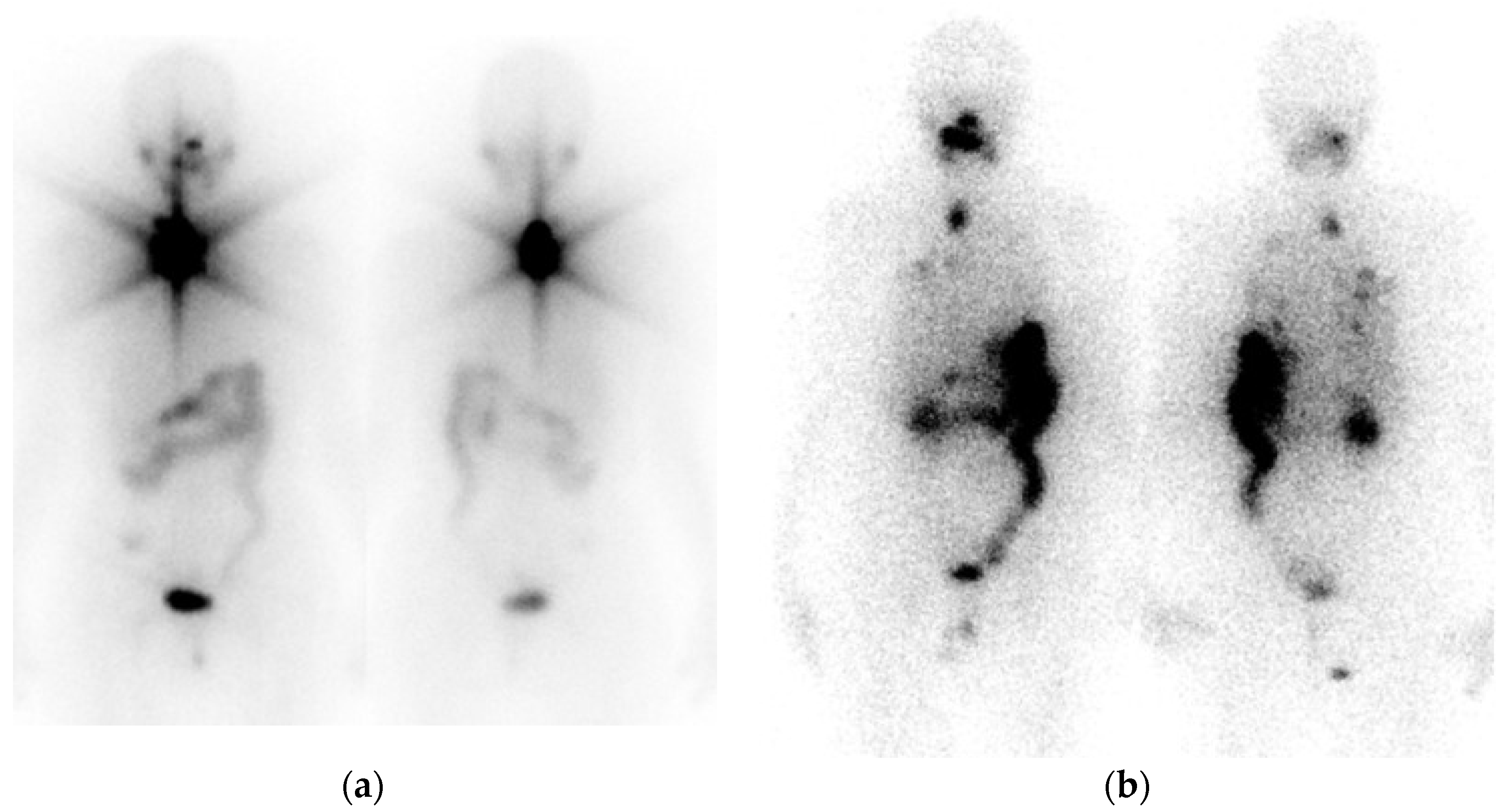 Jcm 13 01984 g003 Jcm 13 01984 g003