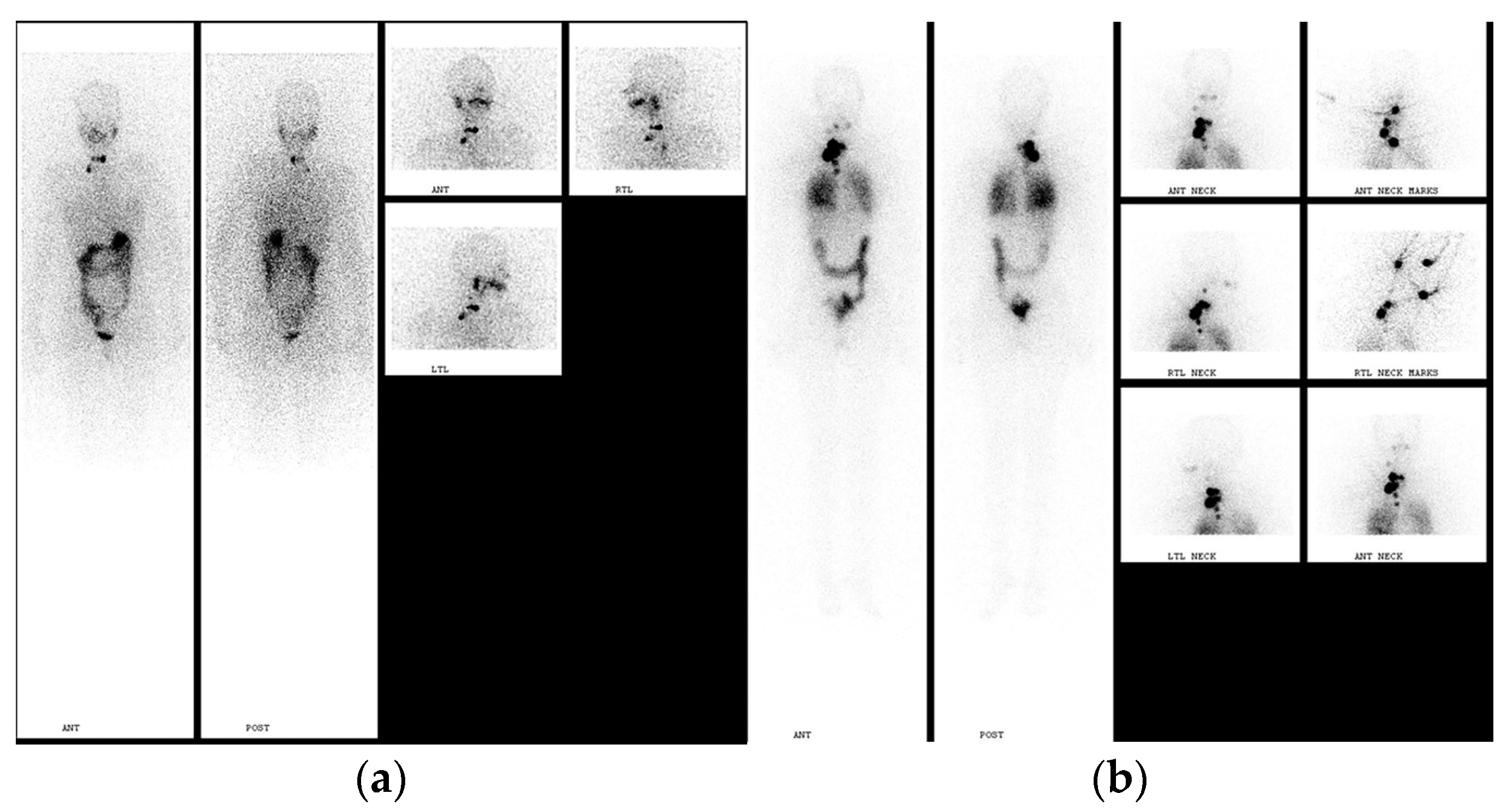 Jcm 13 01984 g004 Jcm 13 01984 g004