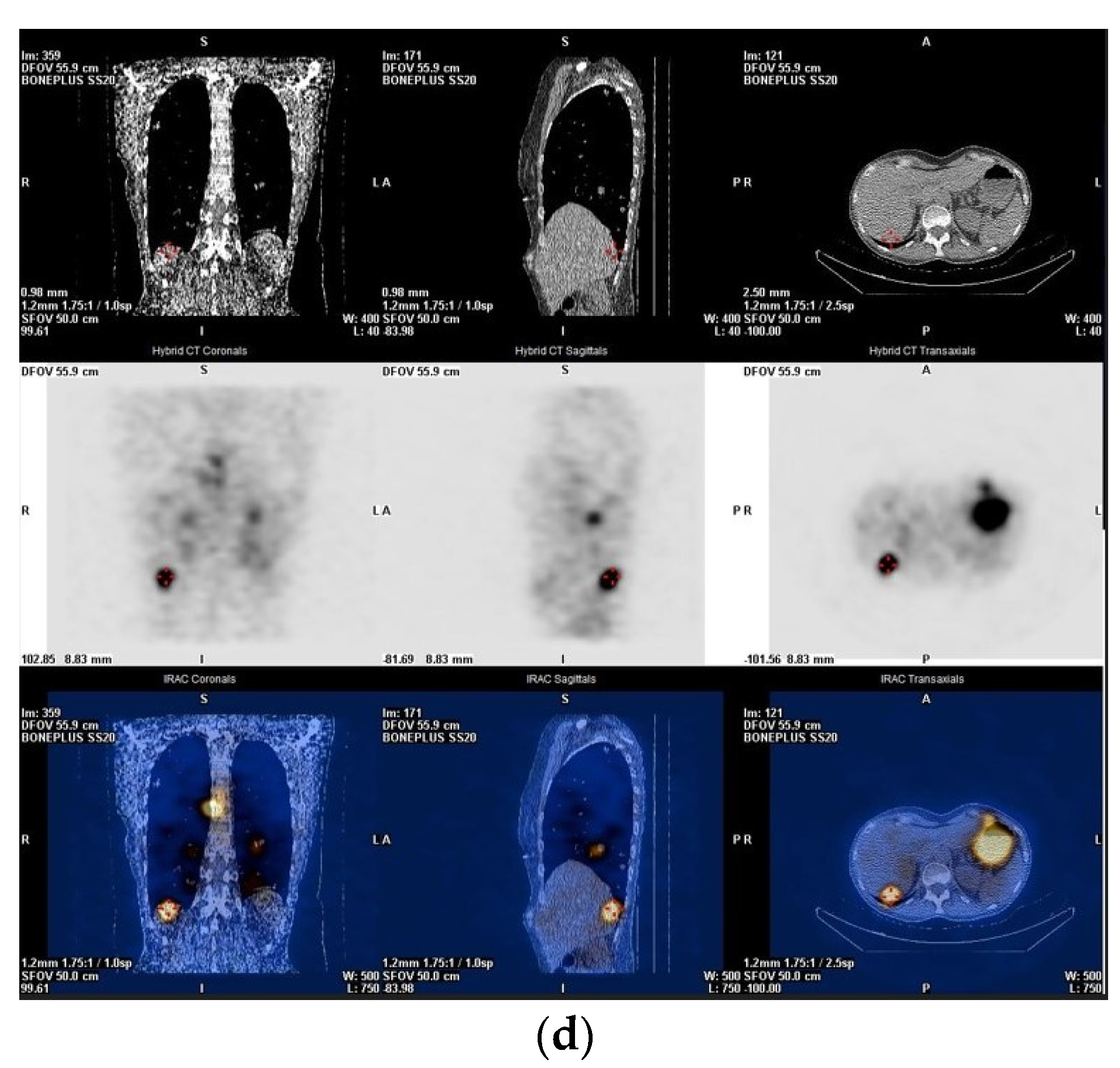 Jcm 13 01984 g005b Jcm 13 01984 g005b