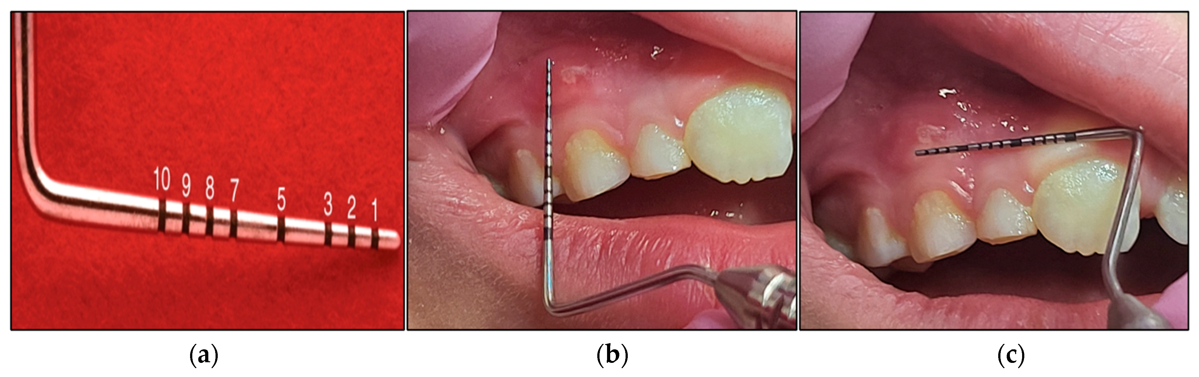 Jcm 13 02007 g004 Jcm 13 02007 g004