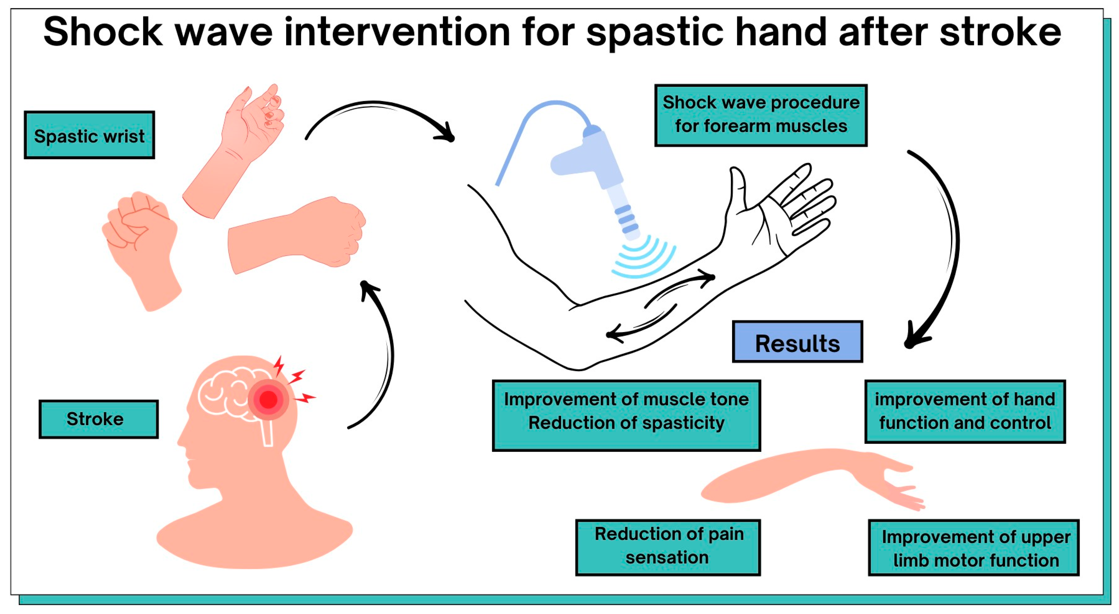 Extracorporeal Shockwave Treatment as Additional Therapy in Patients