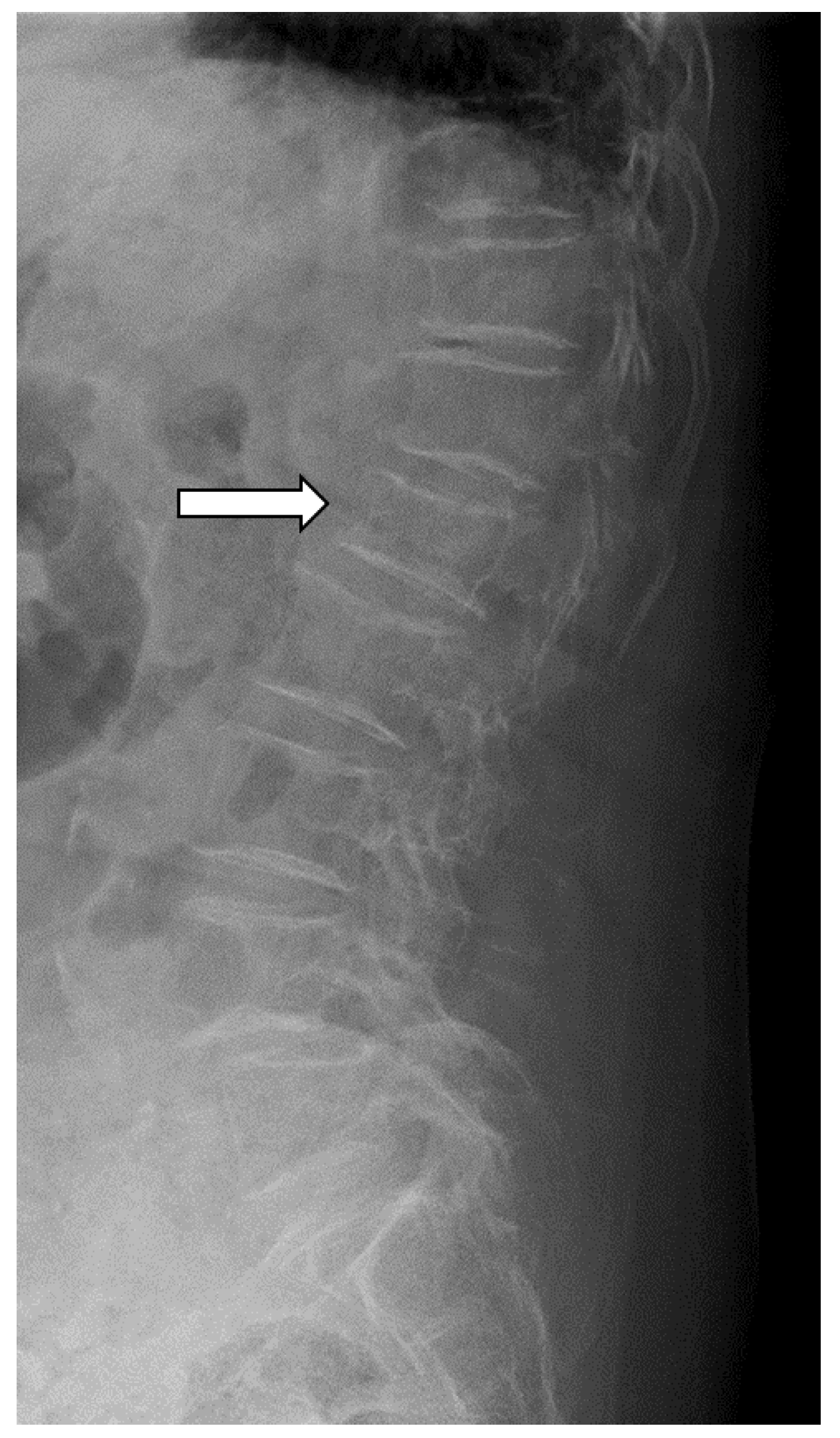 Jcm 13 02063 g002 Jcm 13 02063 g002