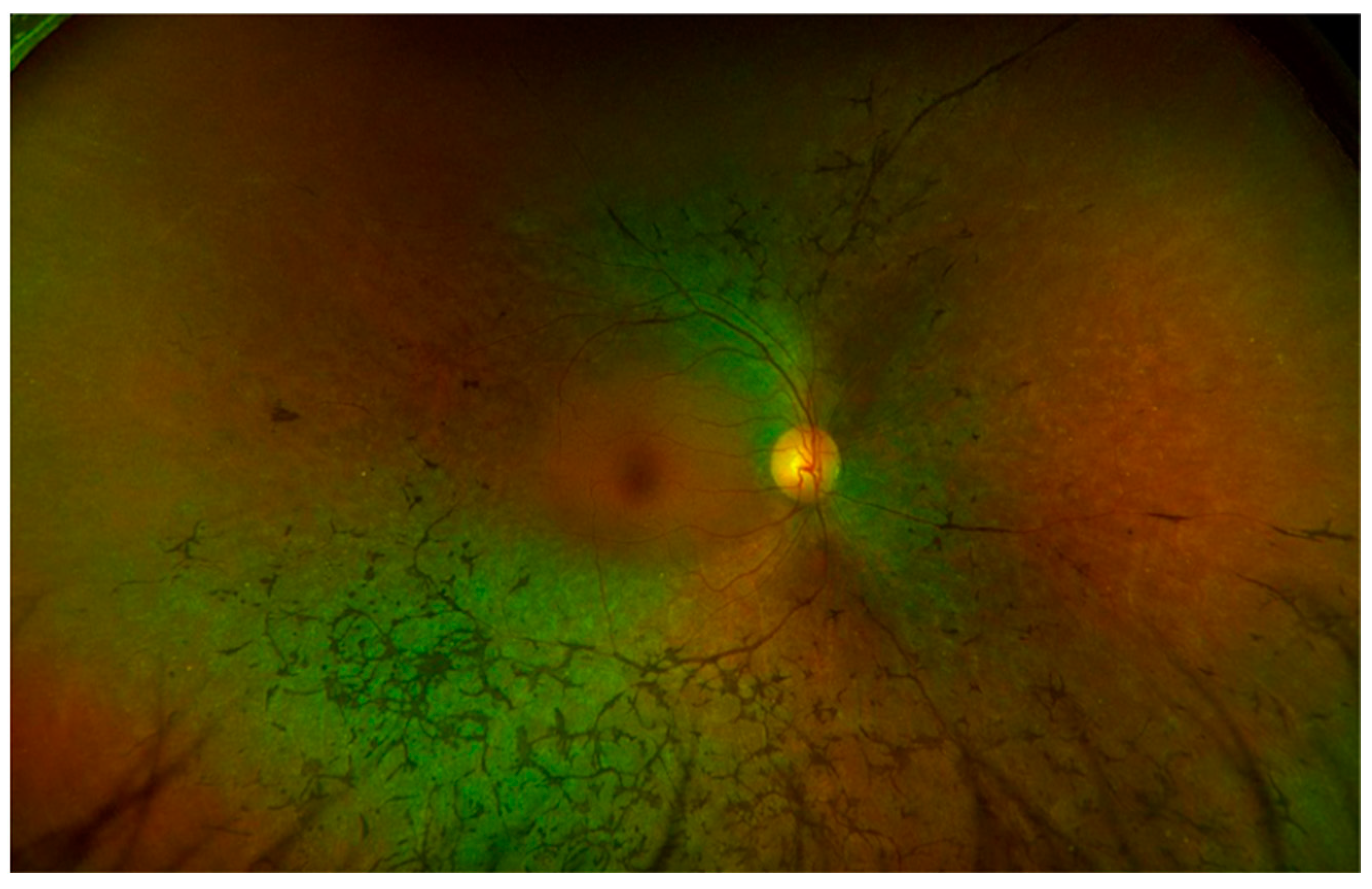 Jcm 13 02079 g002 Jcm 13 02079 g002