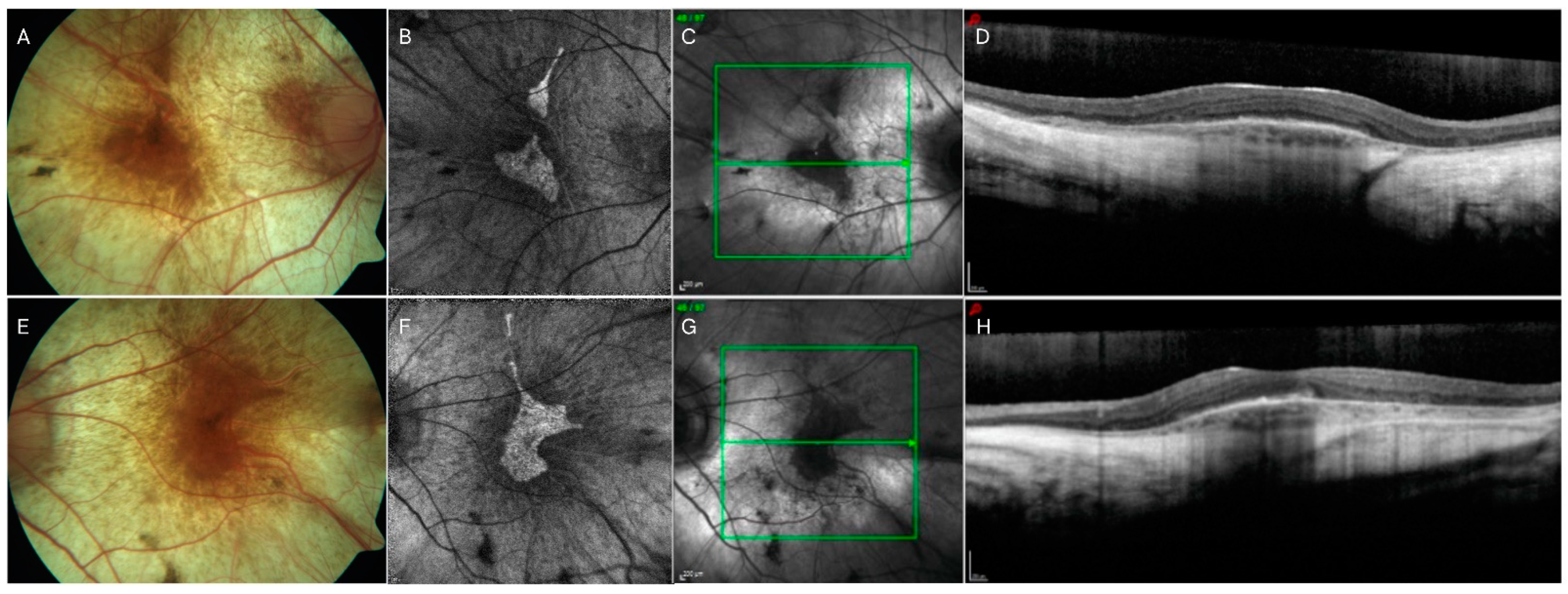 Jcm 13 02079 g004 Jcm 13 02079 g004