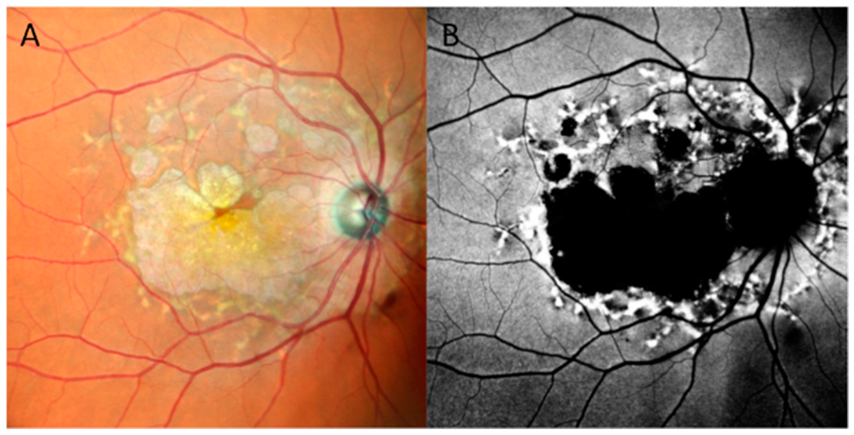 Jcm 13 02079 g005 Jcm 13 02079 g005