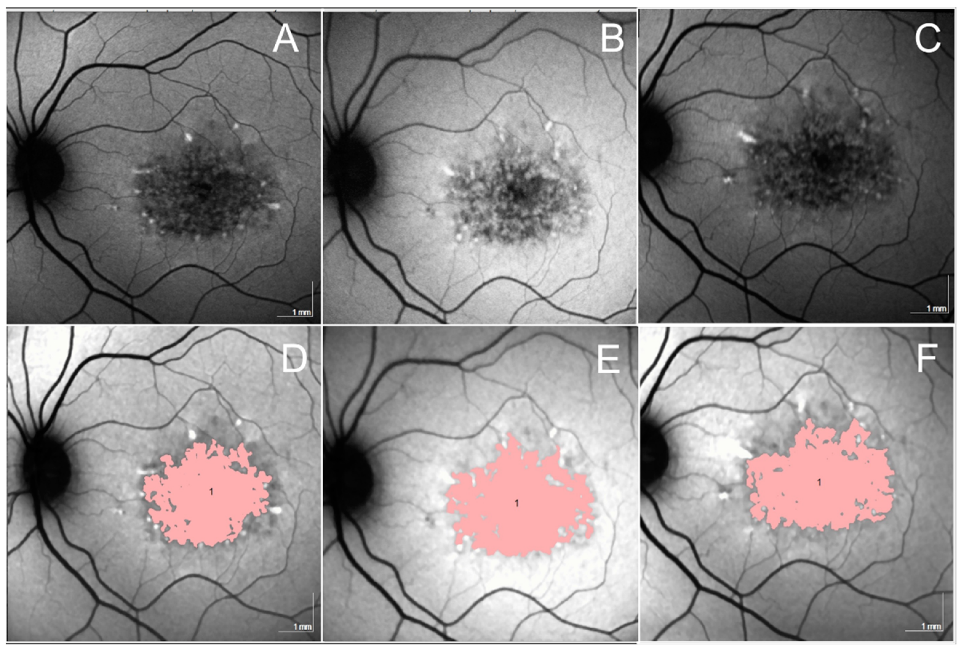 Jcm 13 02079 g006 Jcm 13 02079 g006