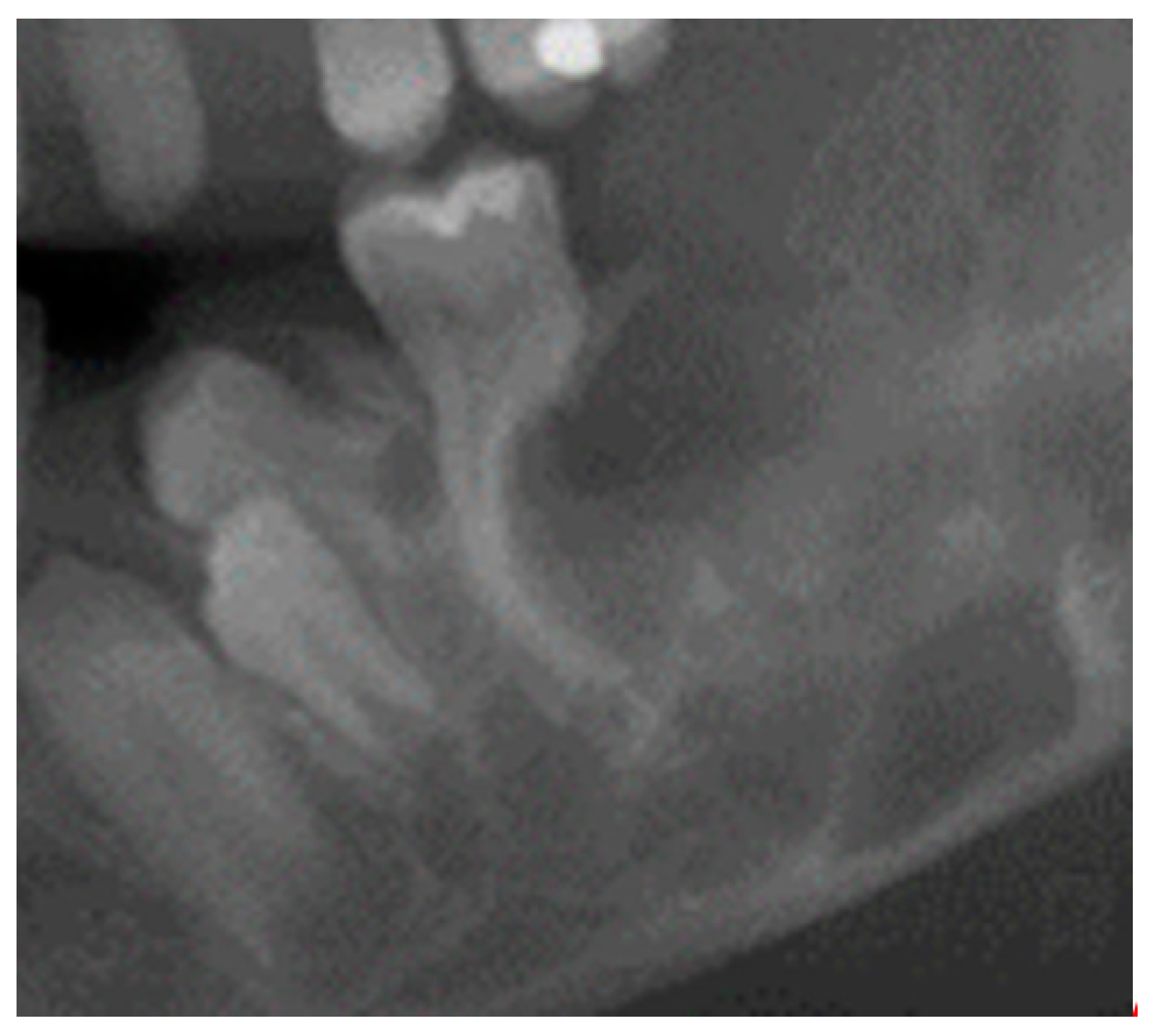 Jcm 13 02082 g002 Jcm 13 02082 g002