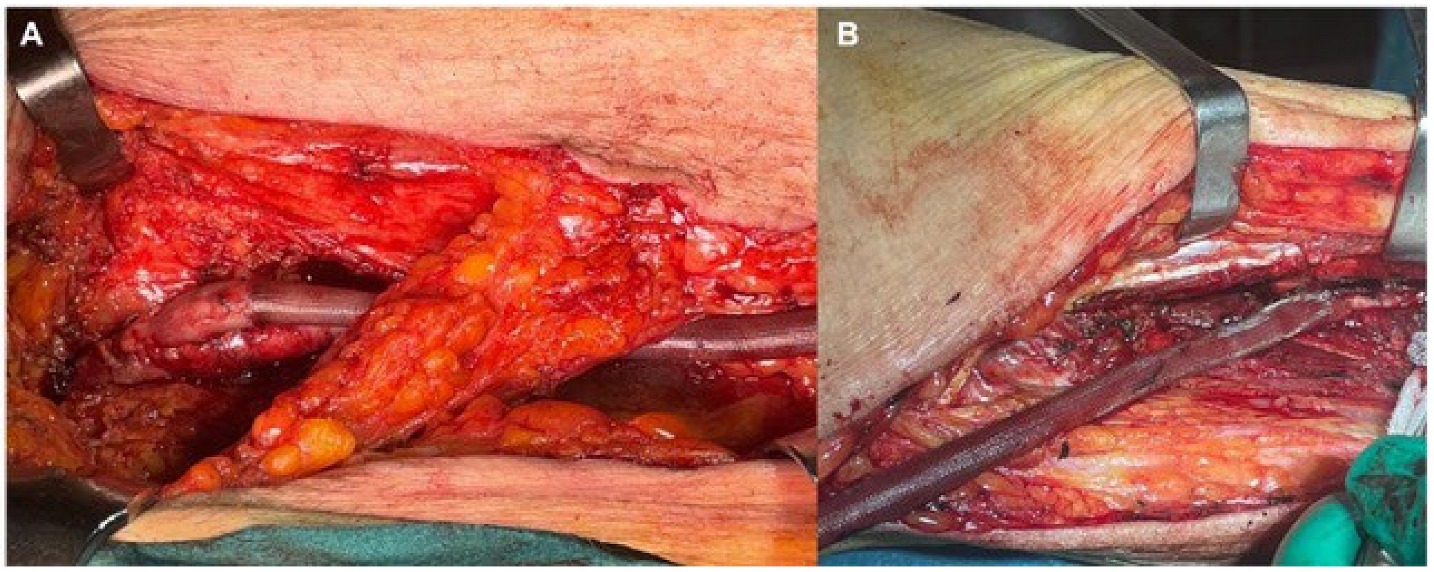 Jcm 13 02095 g002 Jcm 13 02095 g002