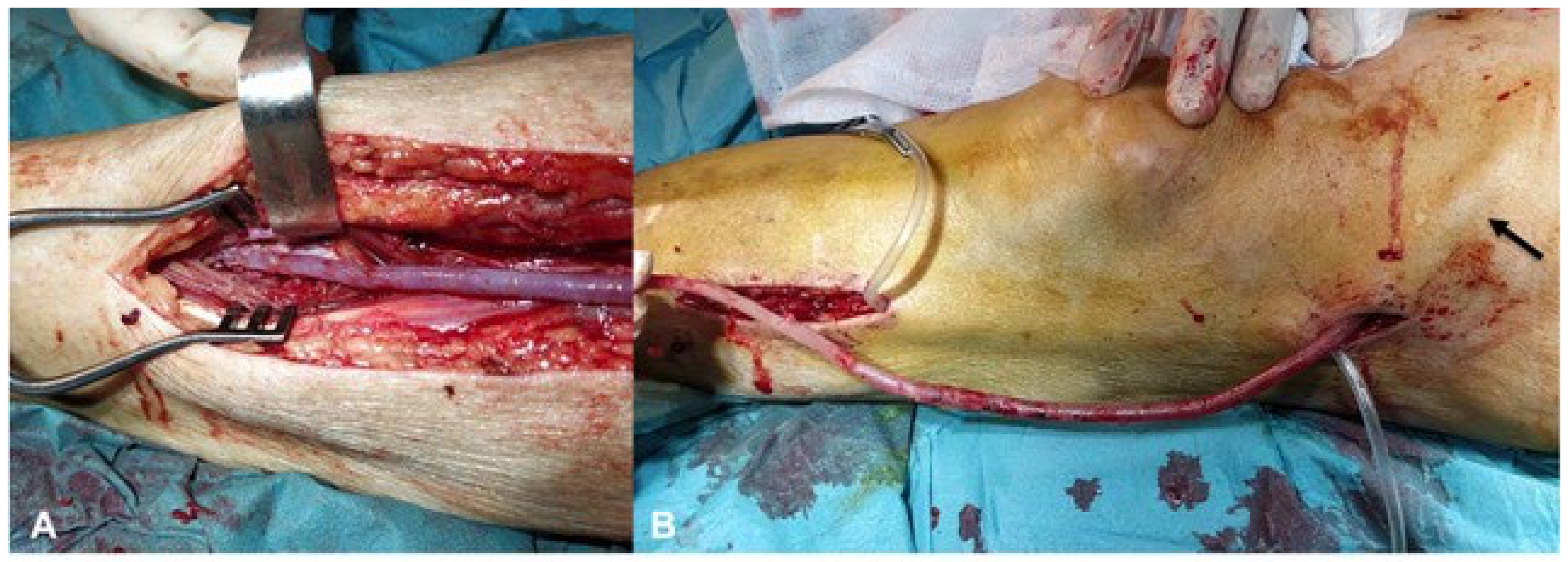 Jcm 13 02095 g003 Jcm 13 02095 g003