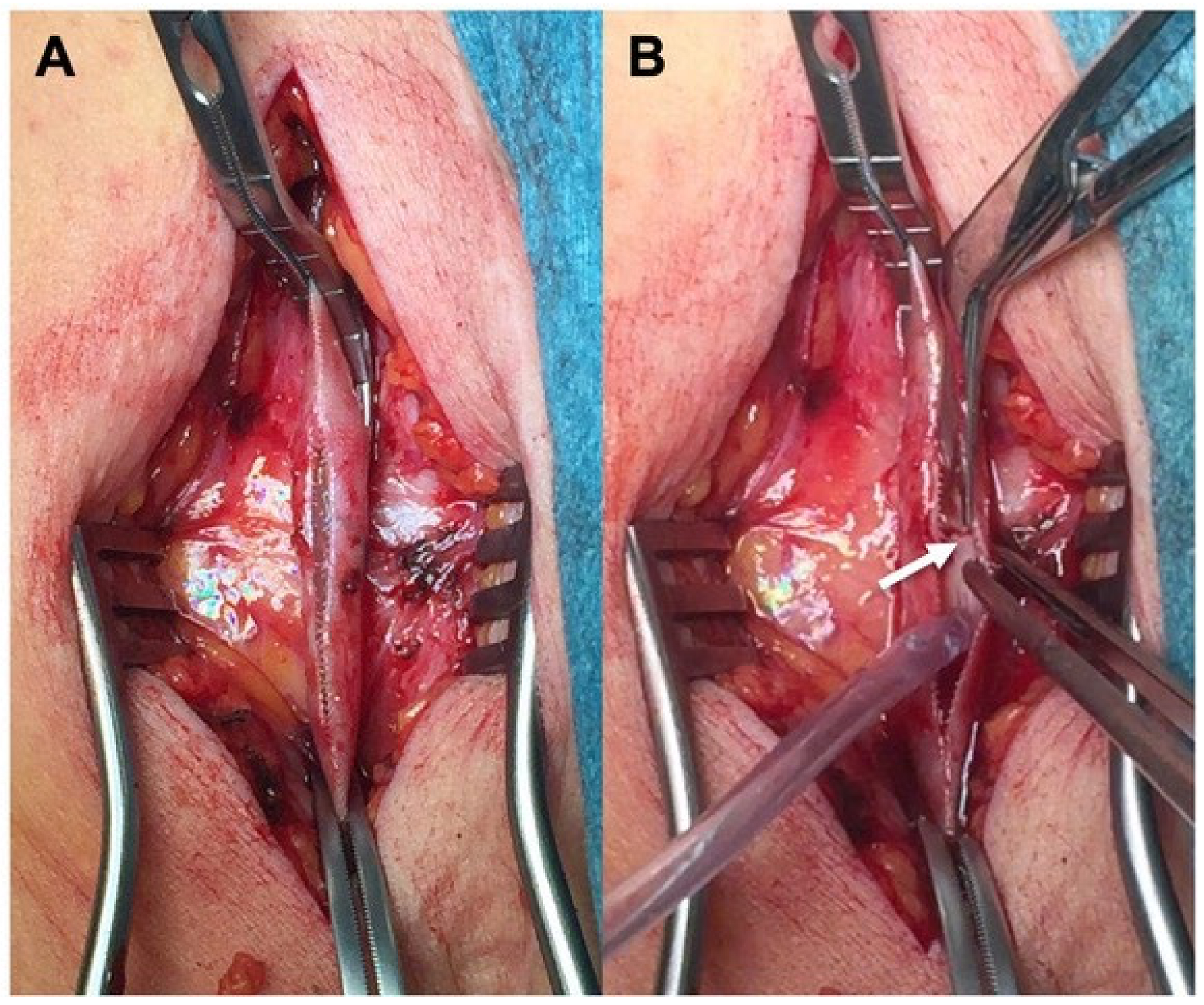 Jcm 13 02095 g004 Jcm 13 02095 g004