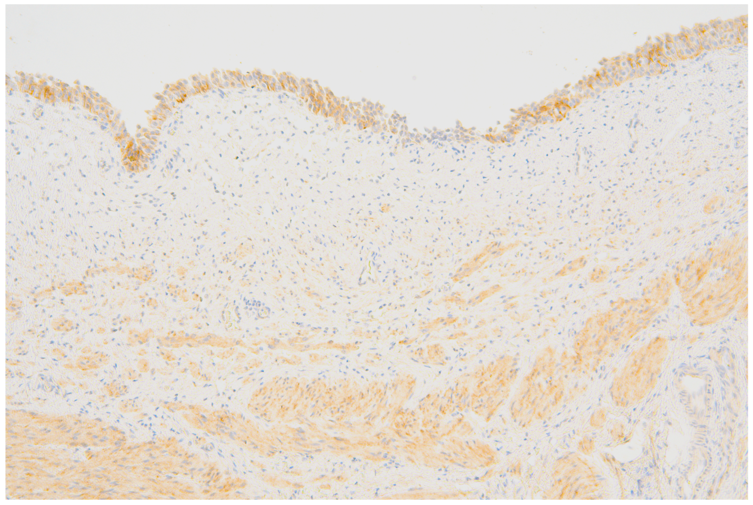Jcm 13 02109 g002 Jcm 13 02109 g002