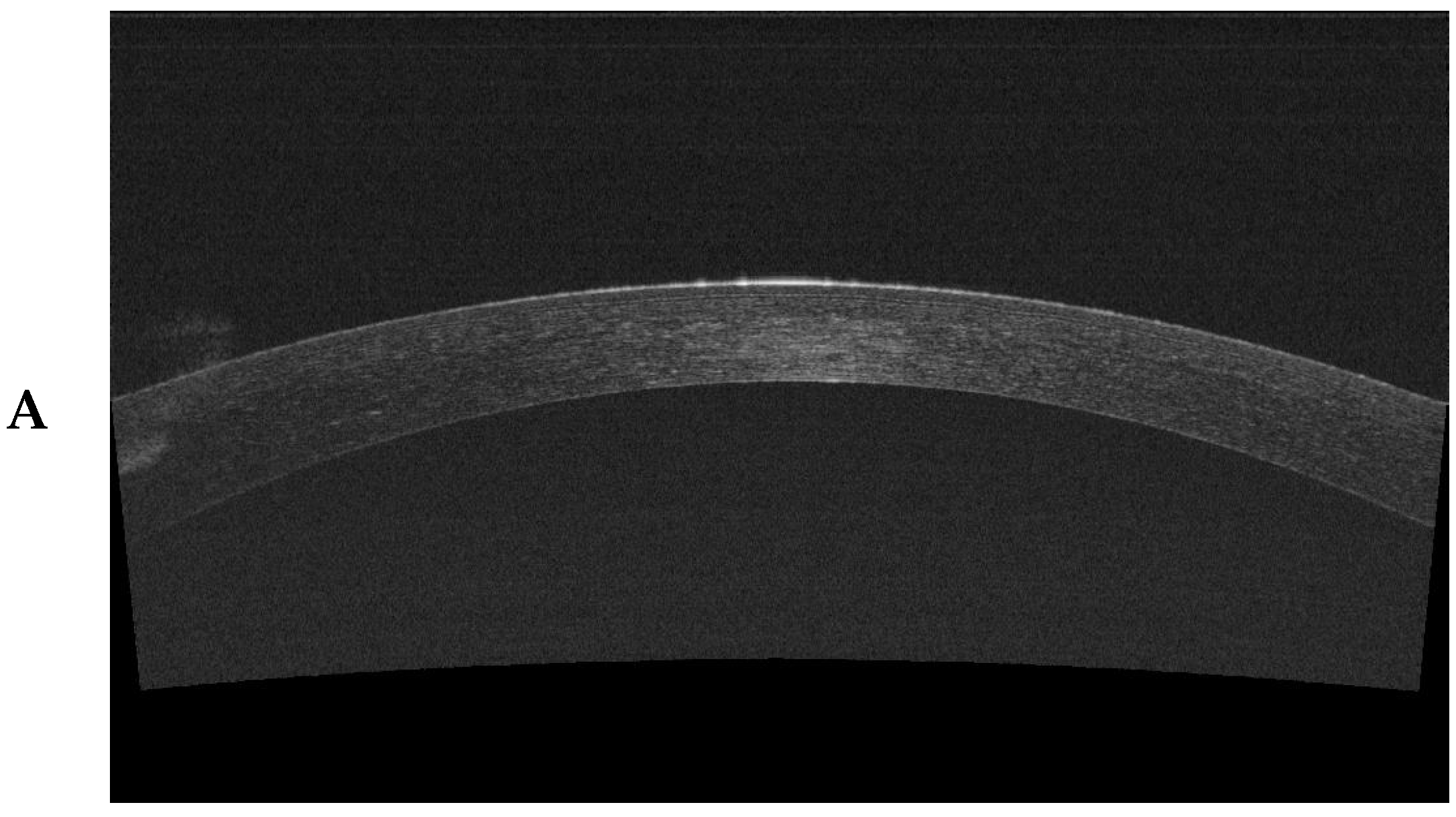 Jcm 13 02148 g001a Jcm 13 02148 g001a