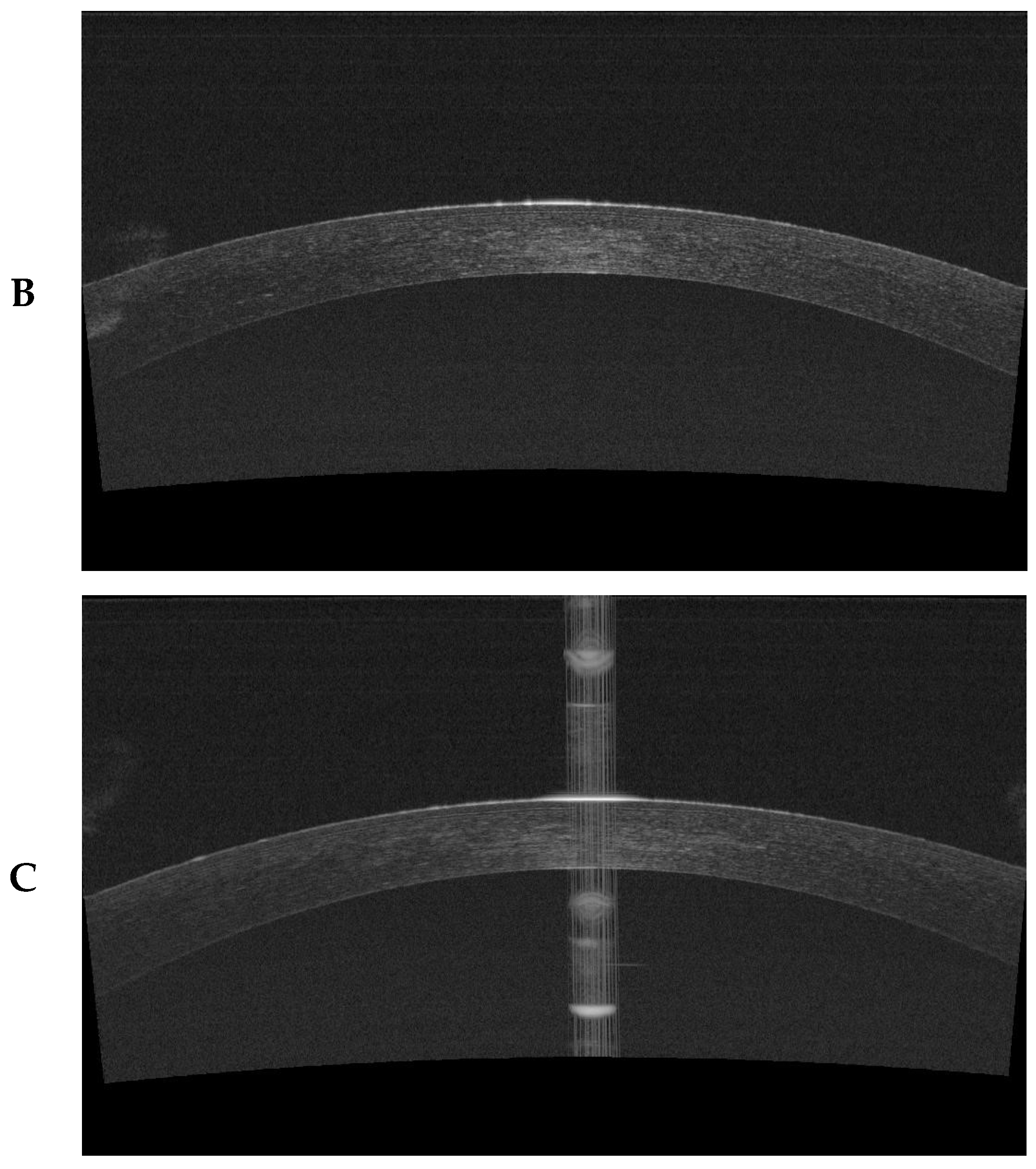 Jcm 13 02148 g001b Jcm 13 02148 g001b