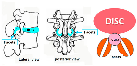 Are the Spinal Changes in the Course of Scoliogeny Primary but