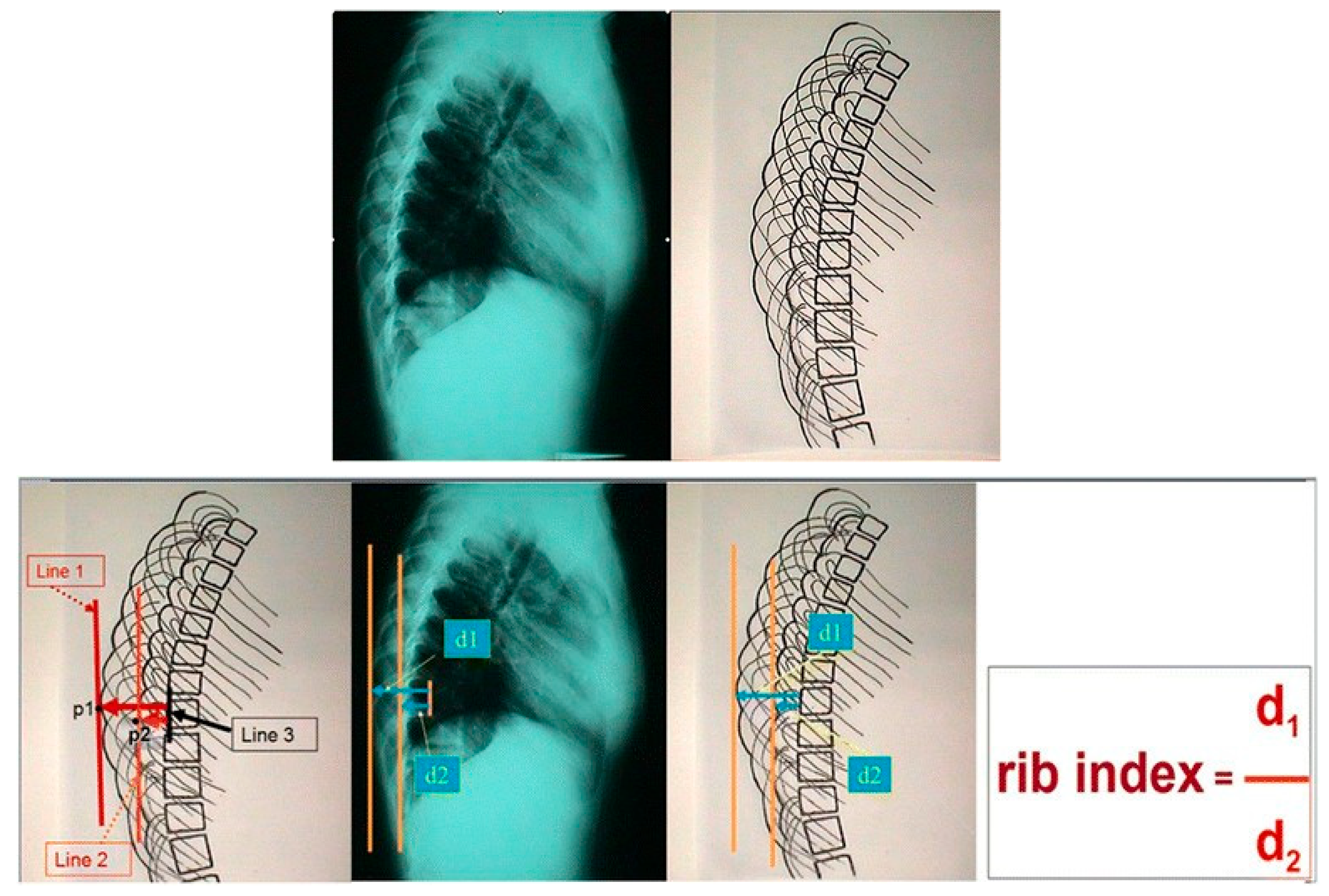 Jcm 13 02163 g005 Jcm 13 02163 g005