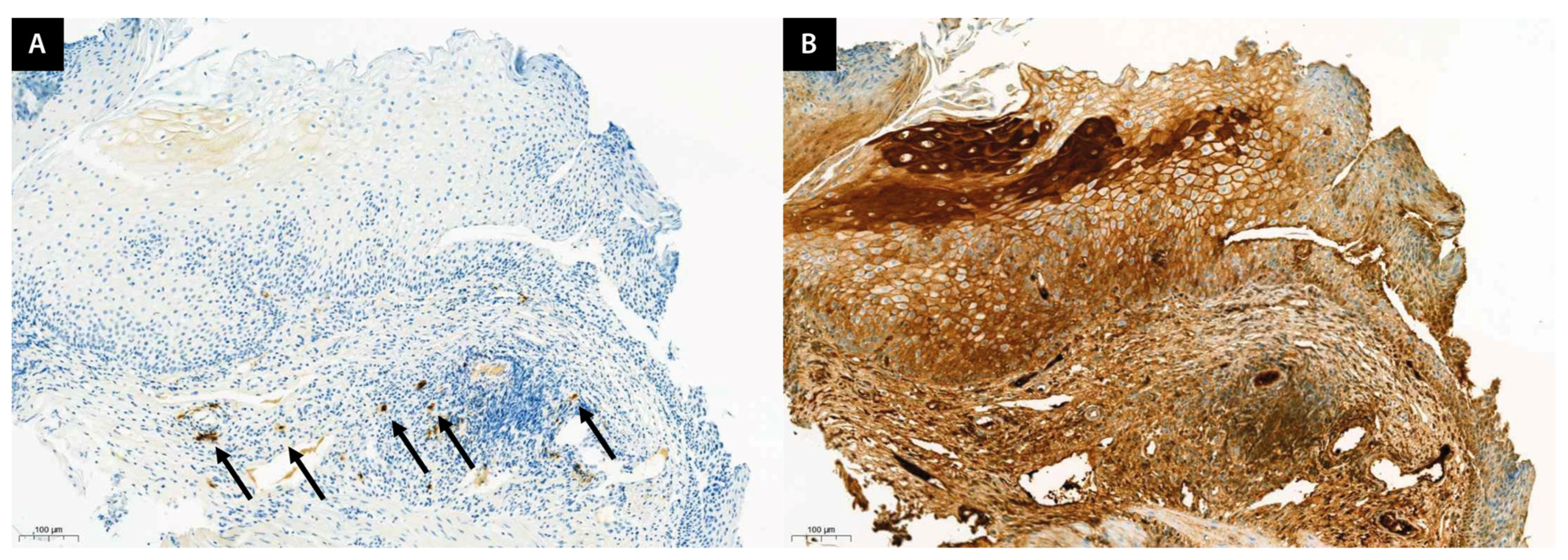 Jcm 13 02175 g002 Jcm 13 02175 g002