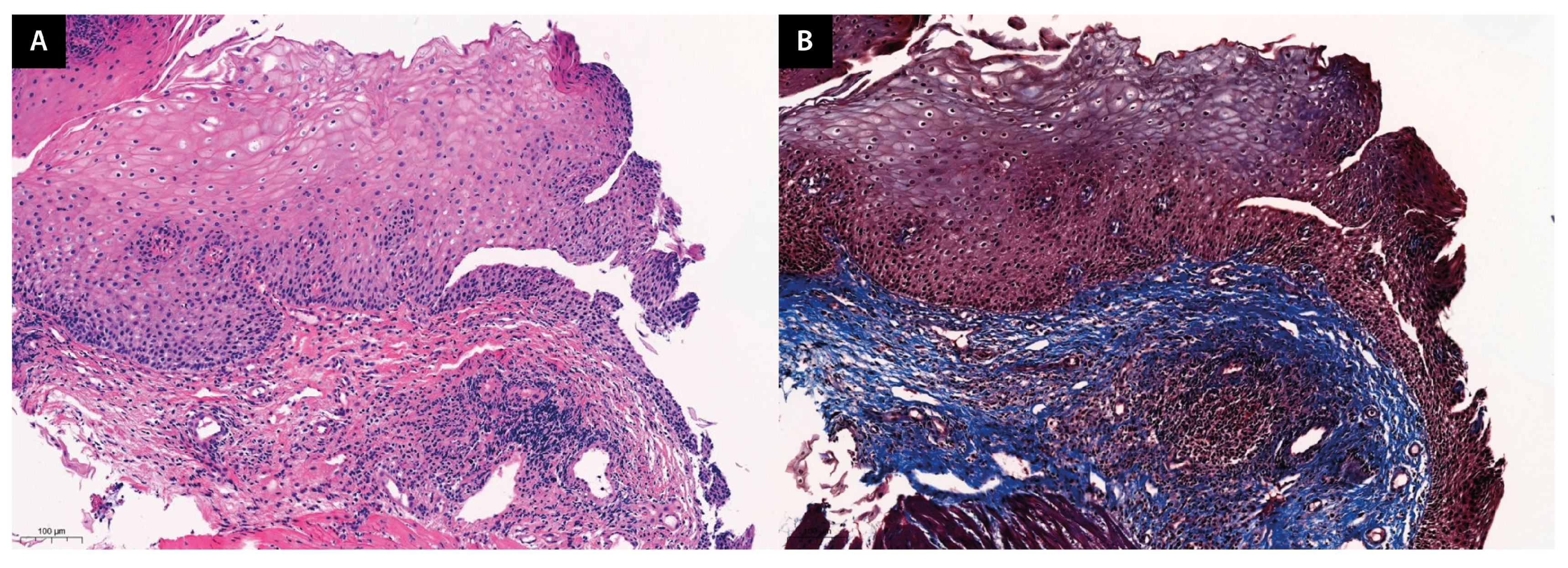 Jcm 13 02175 g003 Jcm 13 02175 g003