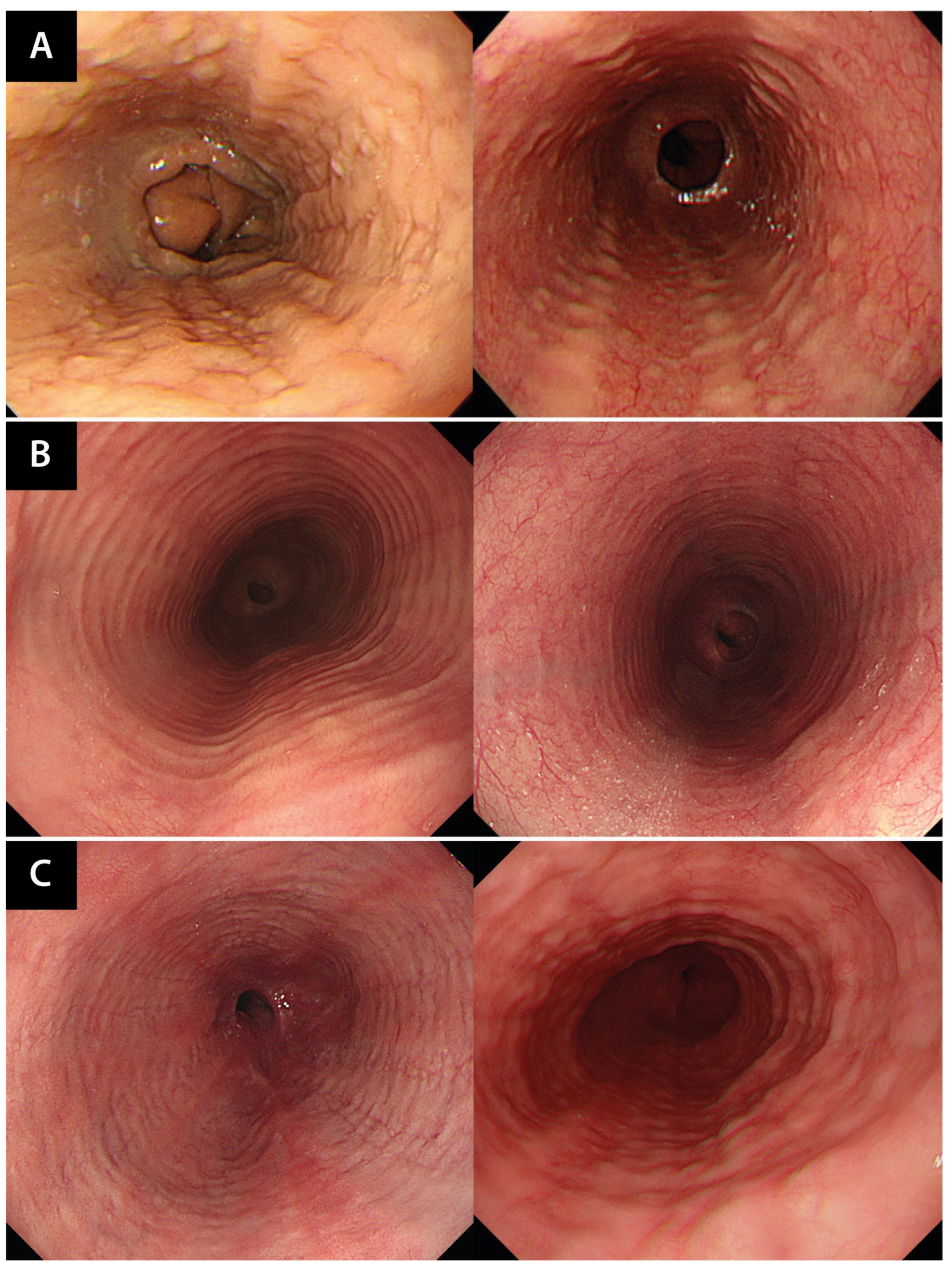Jcm 13 02175 g004 Jcm 13 02175 g004