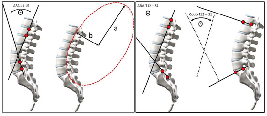 Lordotic Spine Curves