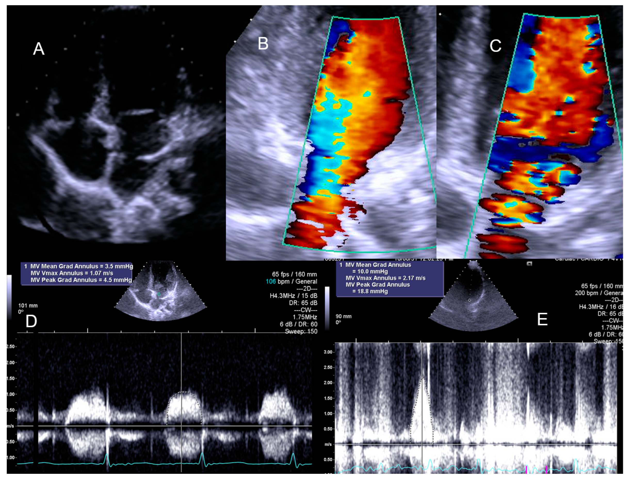 Jcm 13 02191 g008 Jcm 13 02191 g008
