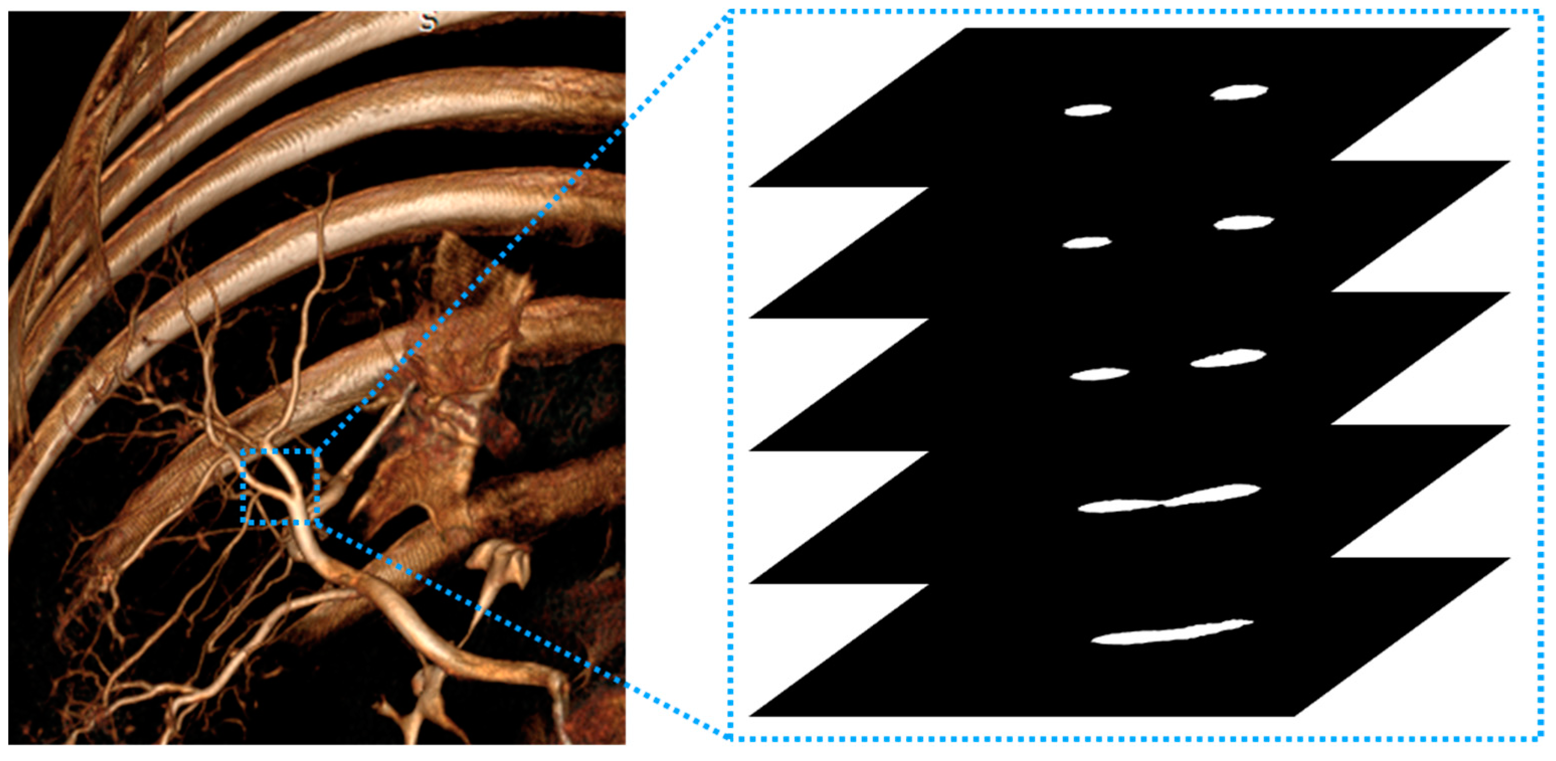 JCM Free FullText Evaluation of Motion Artifact Correction