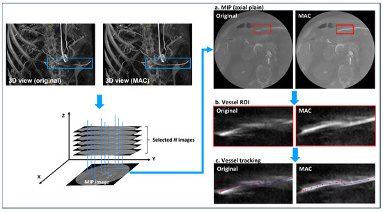 Evaluation of Motion Artifact Correction Technique for Cone-Beam ...