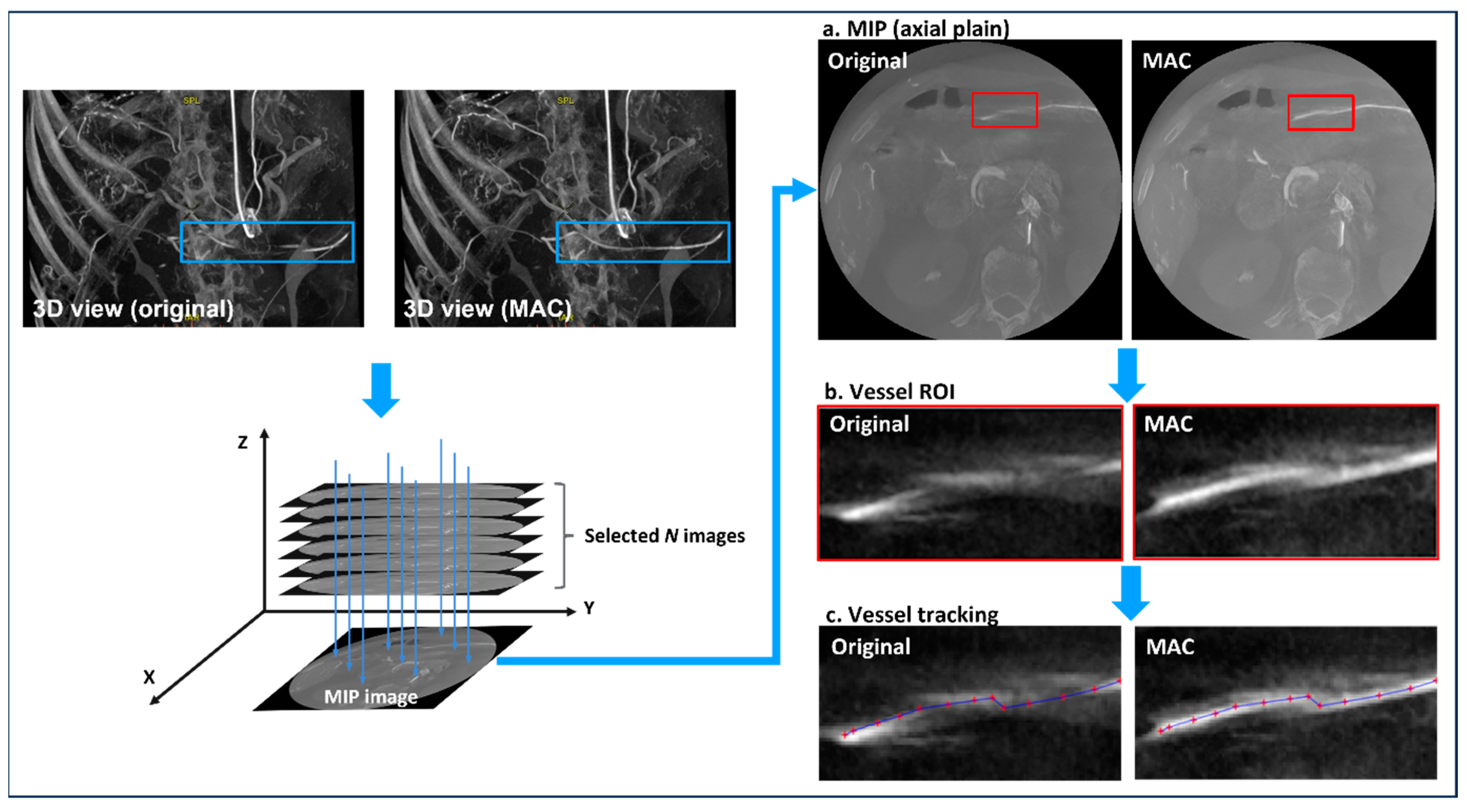 JCM Free FullText Evaluation of Motion Artifact Correction