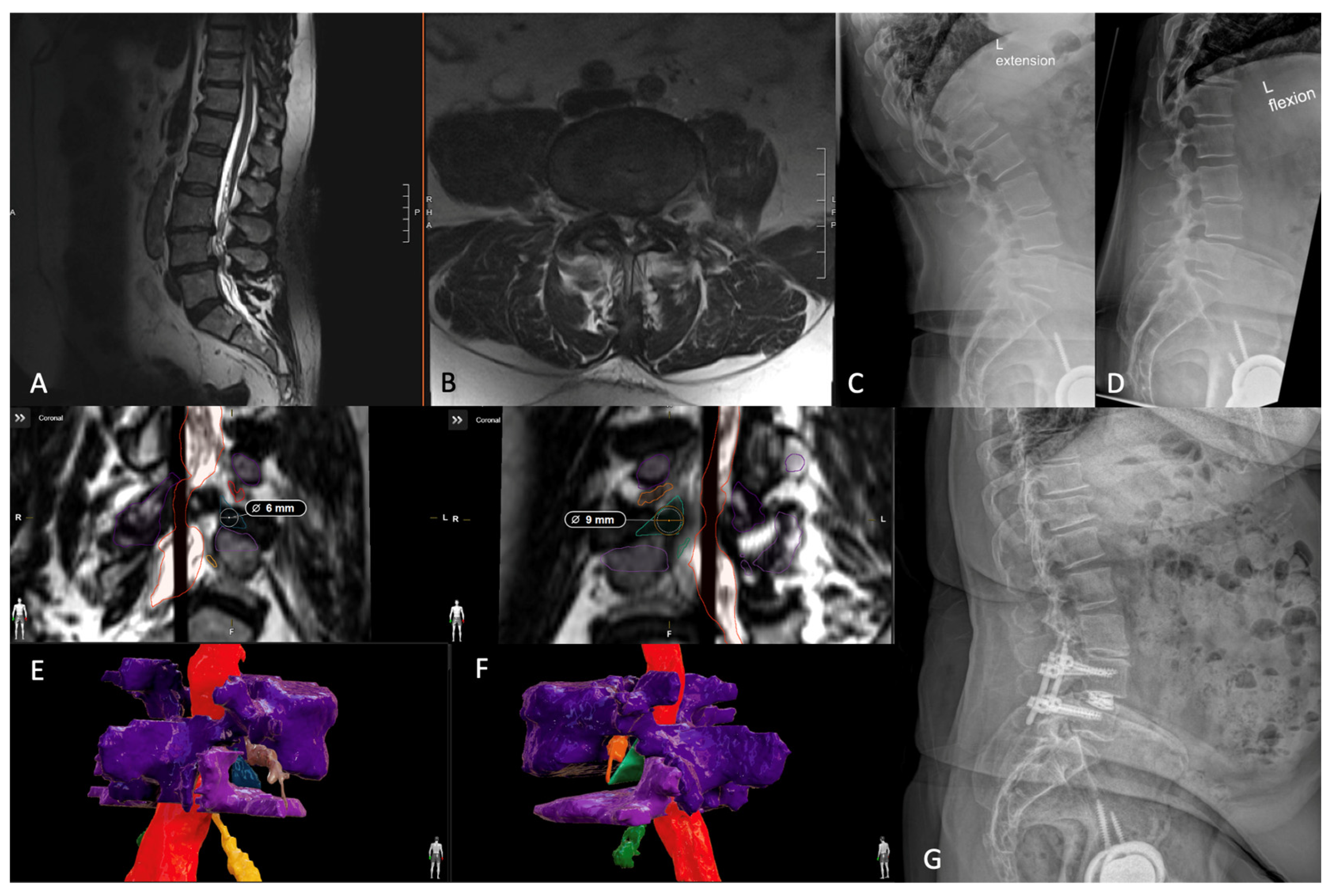 Jcm 13 02271 g005 Jcm 13 02271 g005