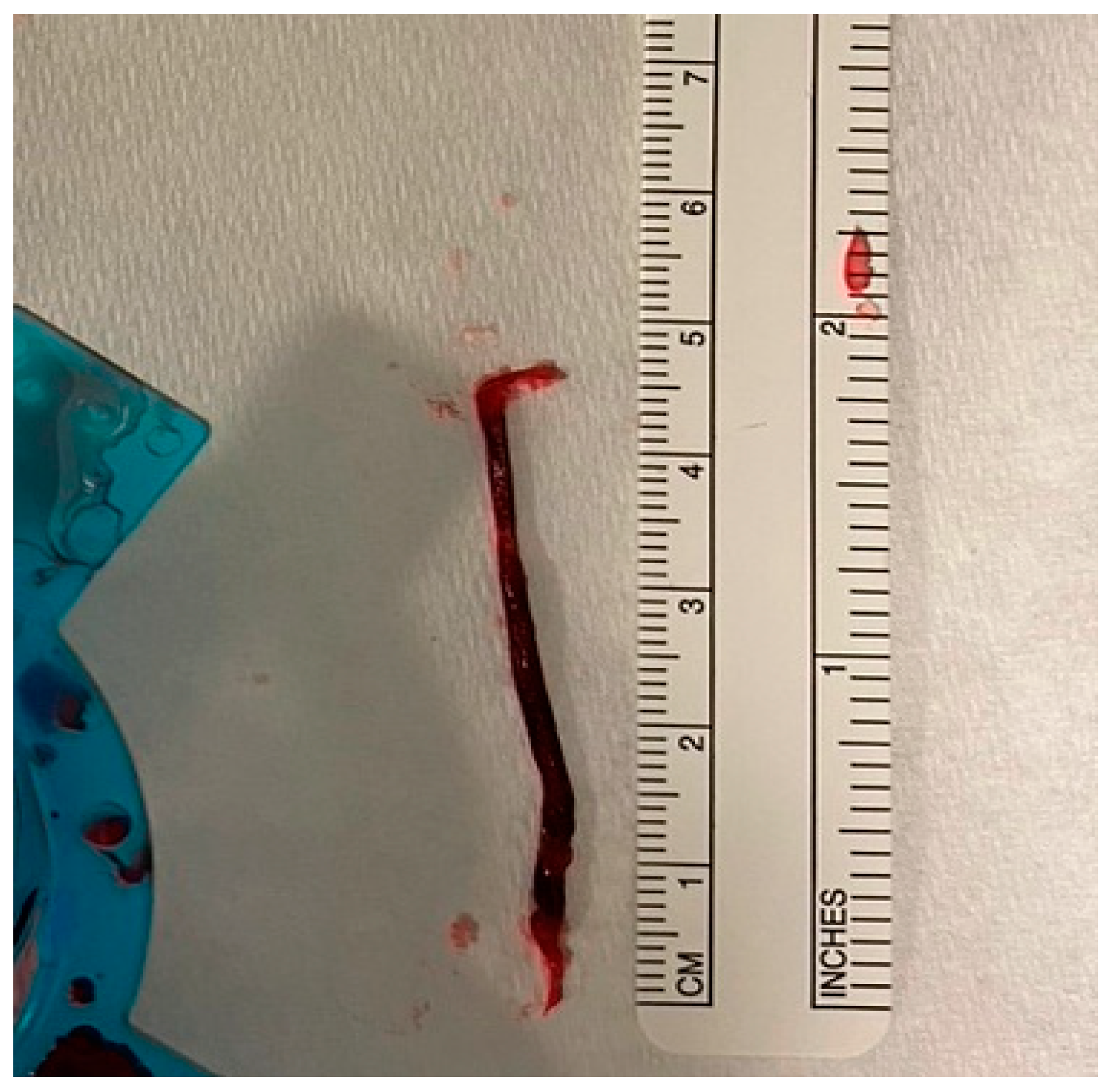 Jcm 13 02291 g001 Jcm 13 02291 g001