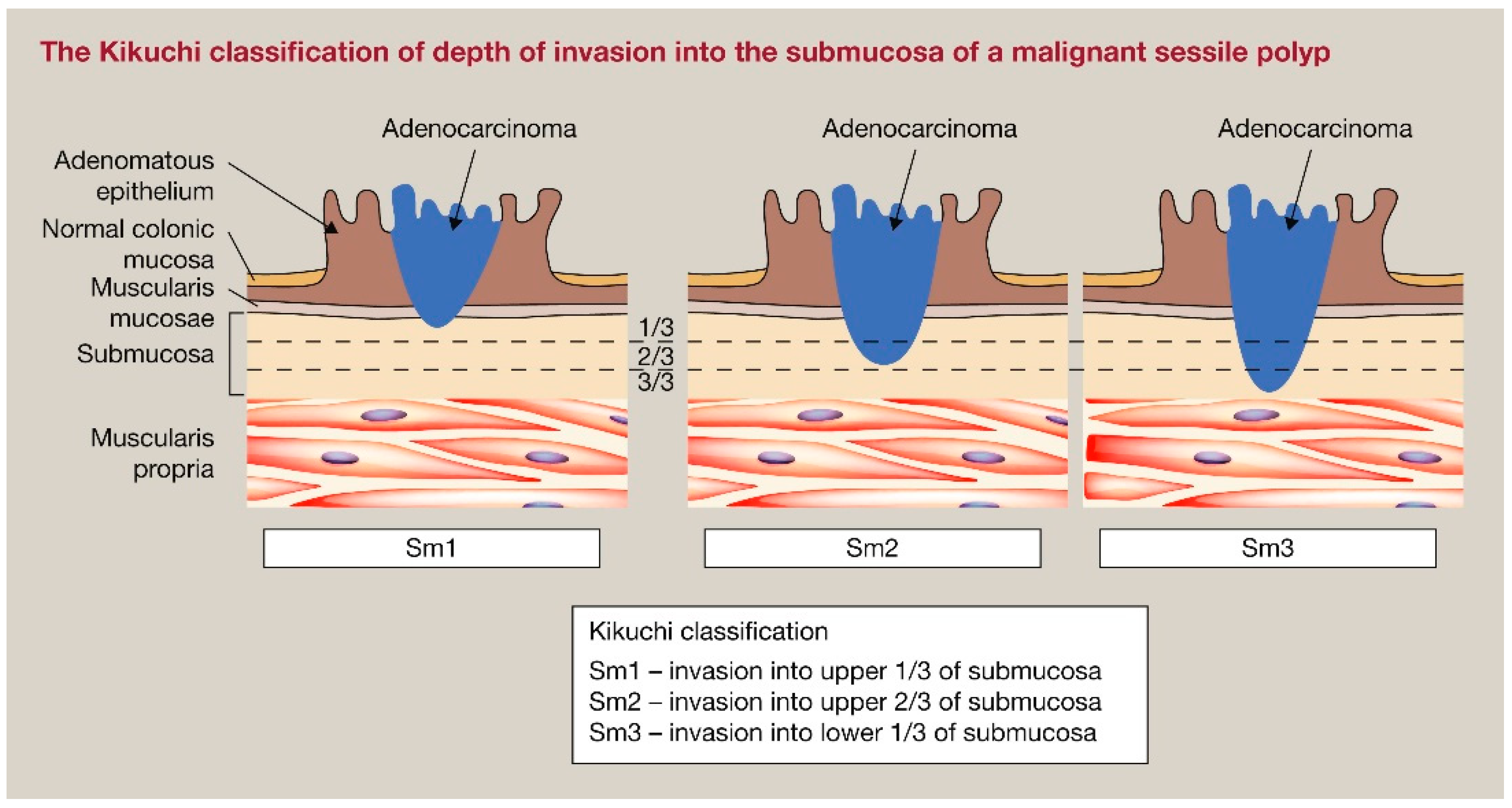 Jcm 13 02292 g002 Jcm 13 02292 g002